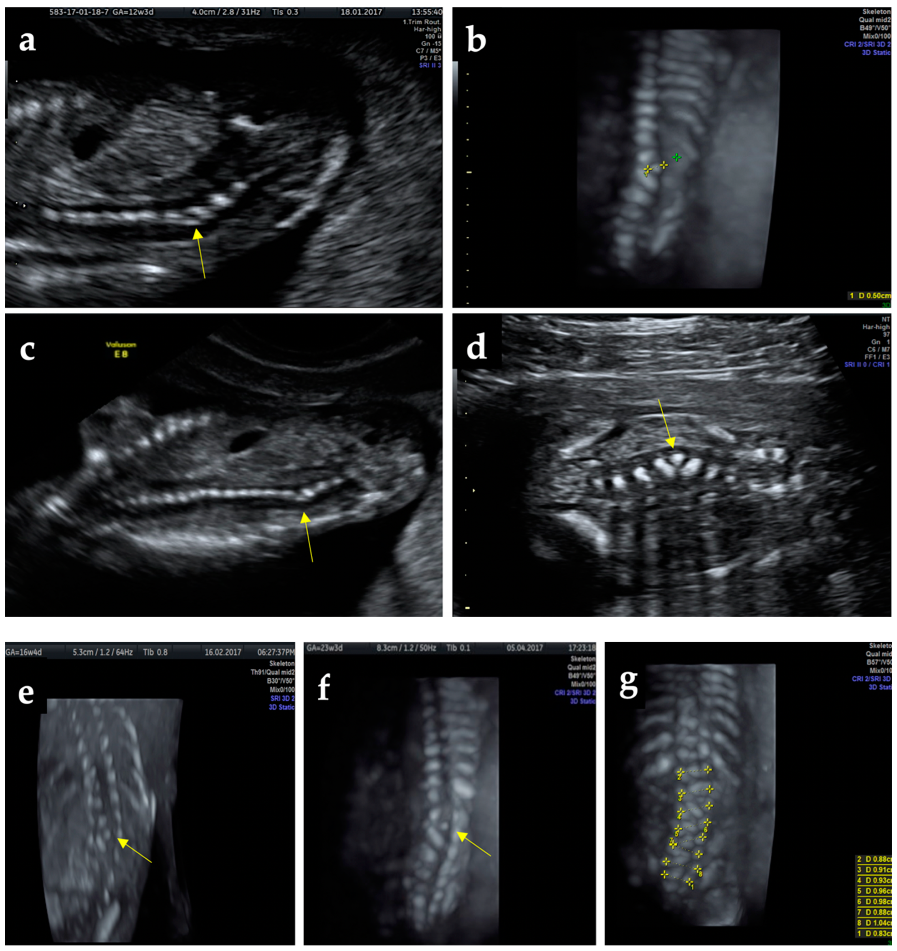 Diagnostics 12 00373 g001a