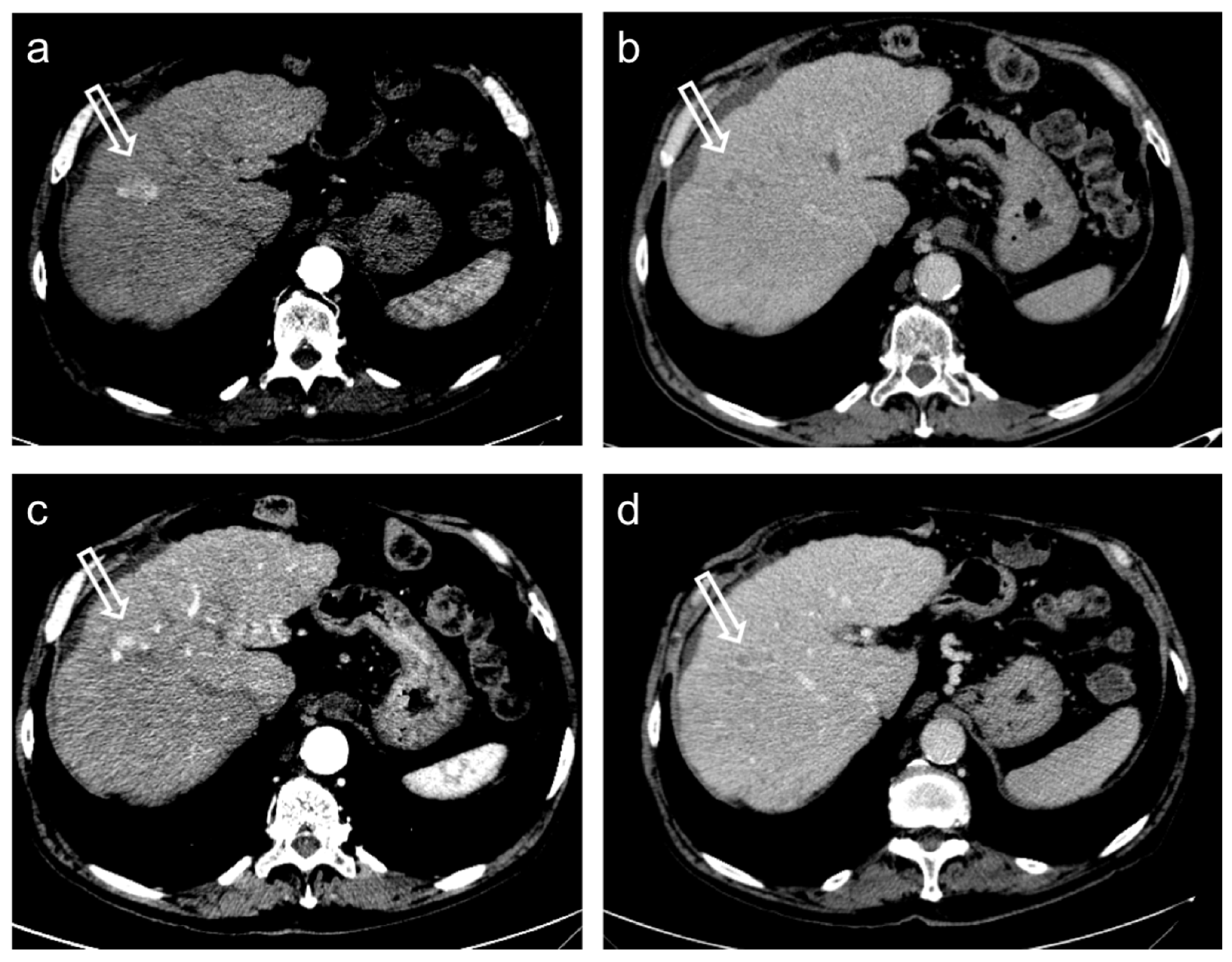 Diagnostics 12 00374 g005