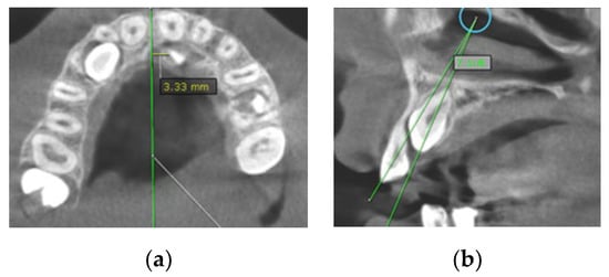 Diagnostics 12 00380 g002 550
