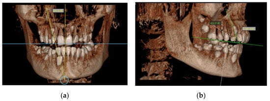 Diagnostics 12 00380 g003 550