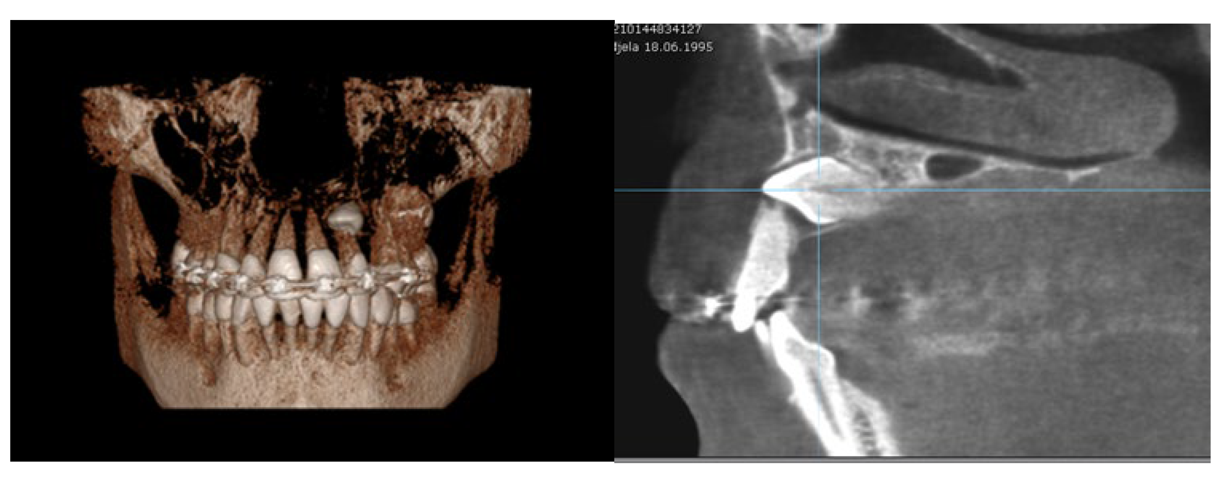 Diagnostics 12 00380 g005