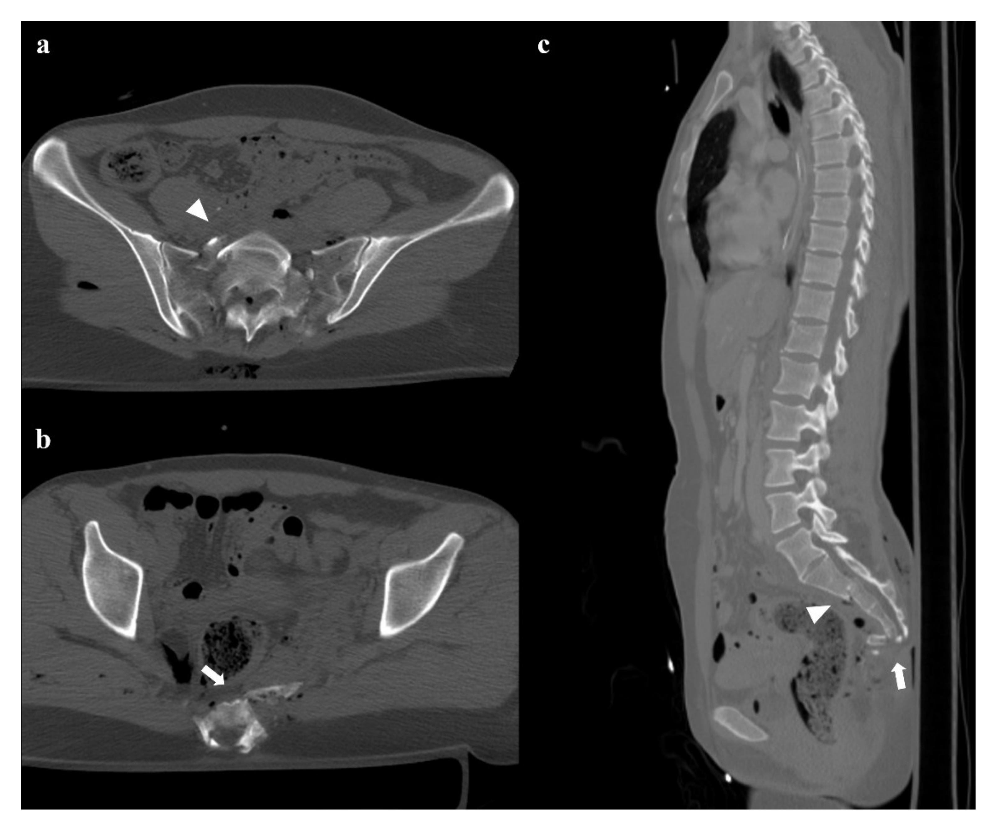 Diagnostics 12 00384 g008