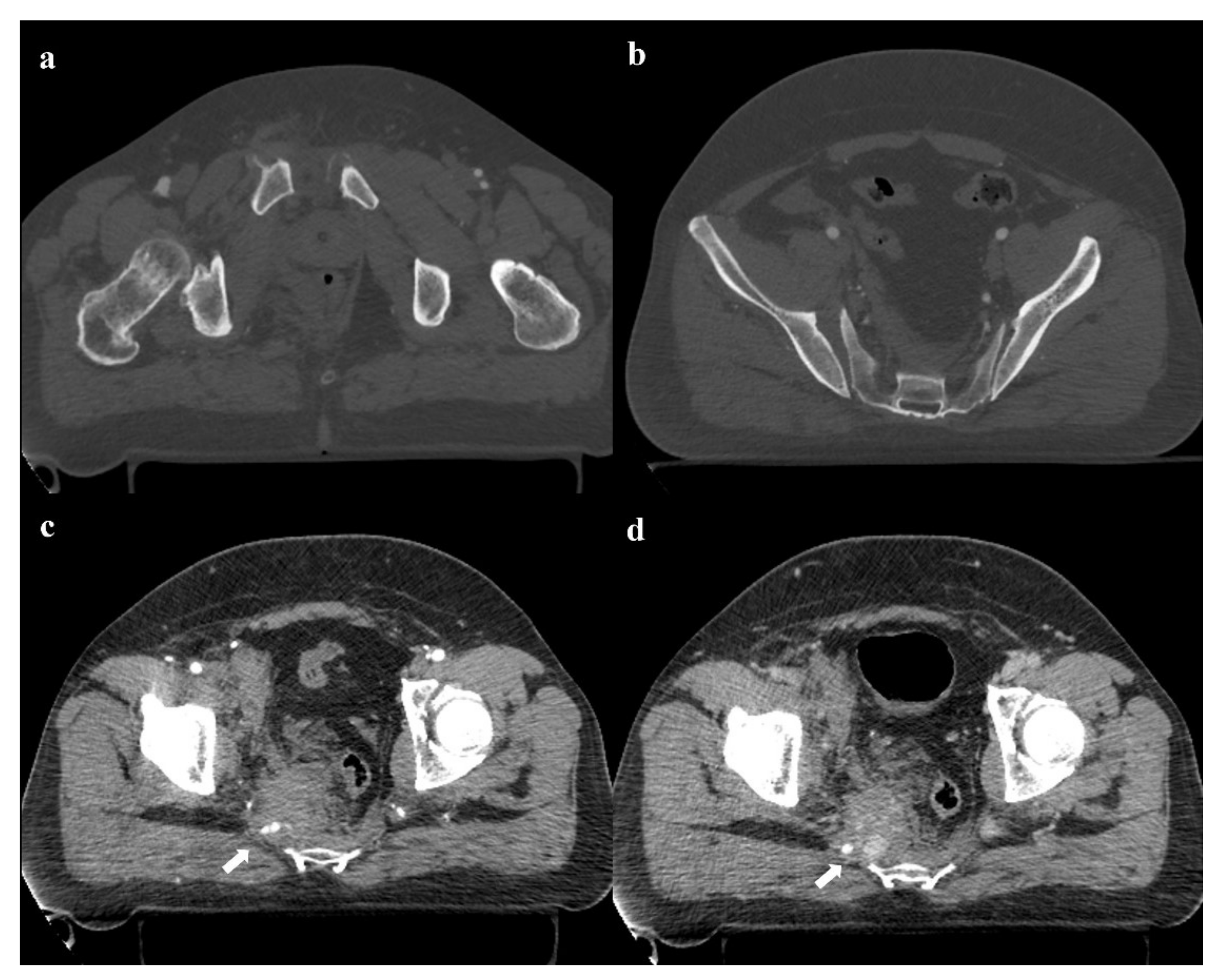 Diagnostics 12 00384 g011