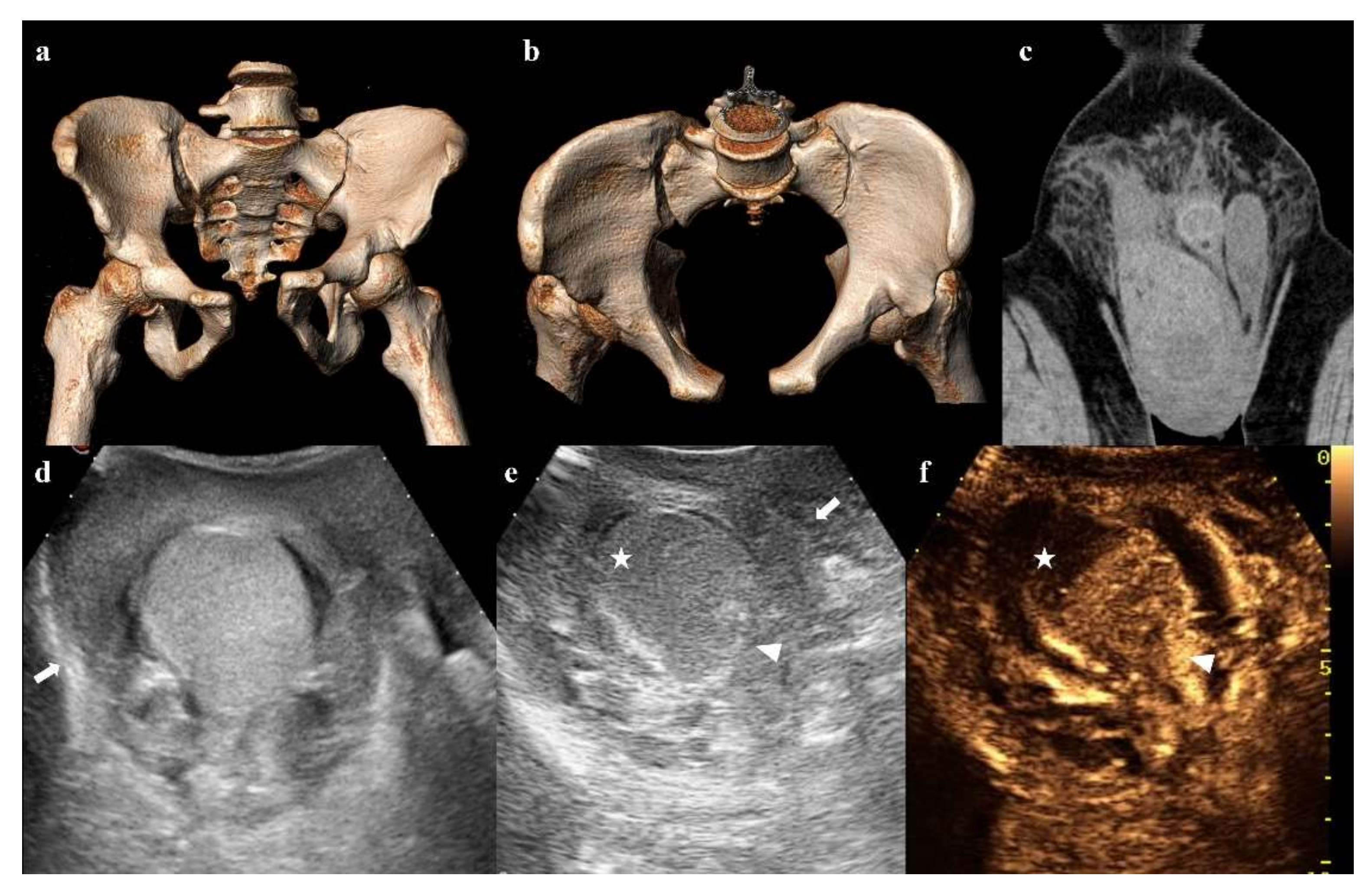 Diagnostics 12 00384 g014