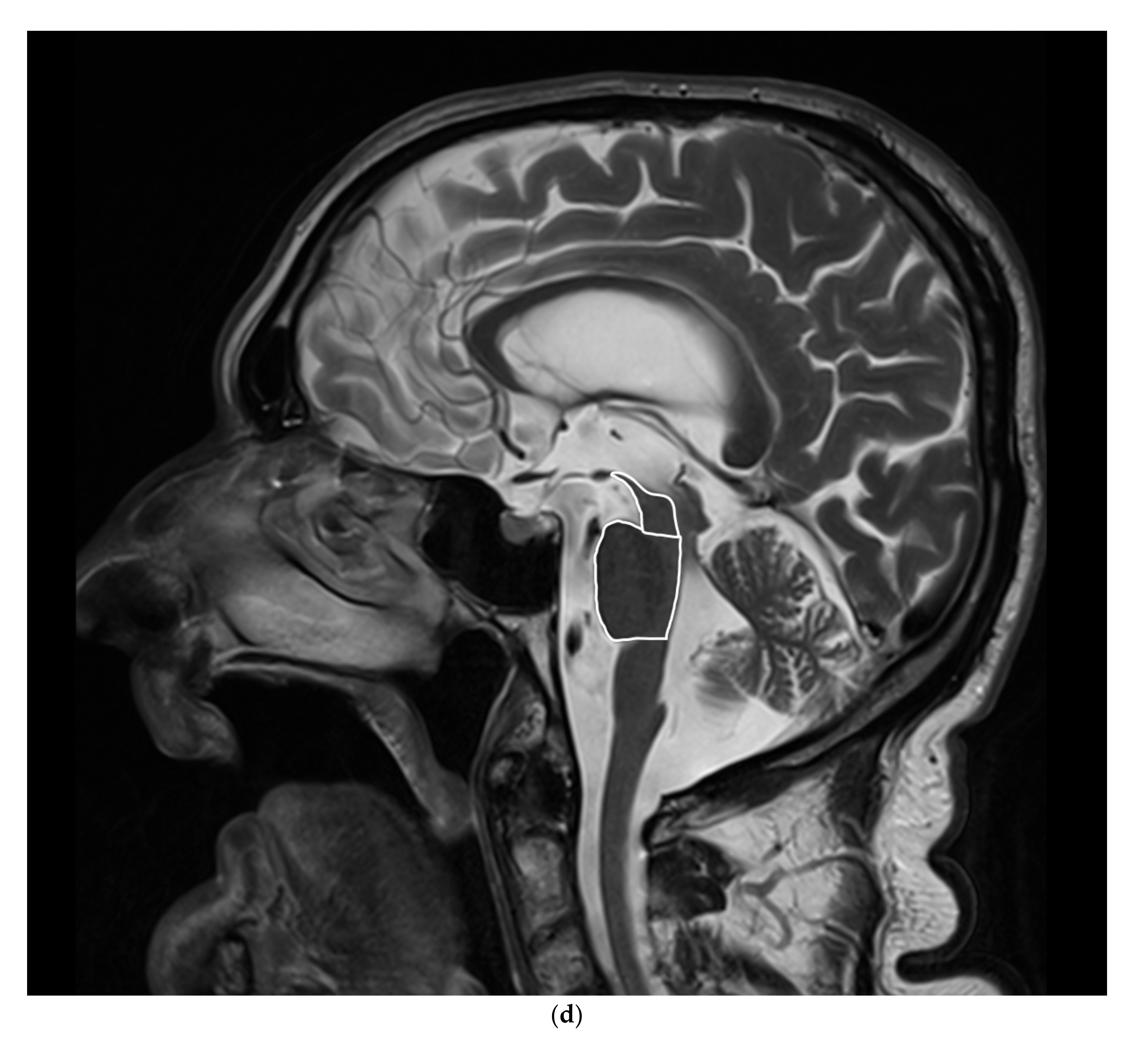 Diagnostics 12 00385 g001c