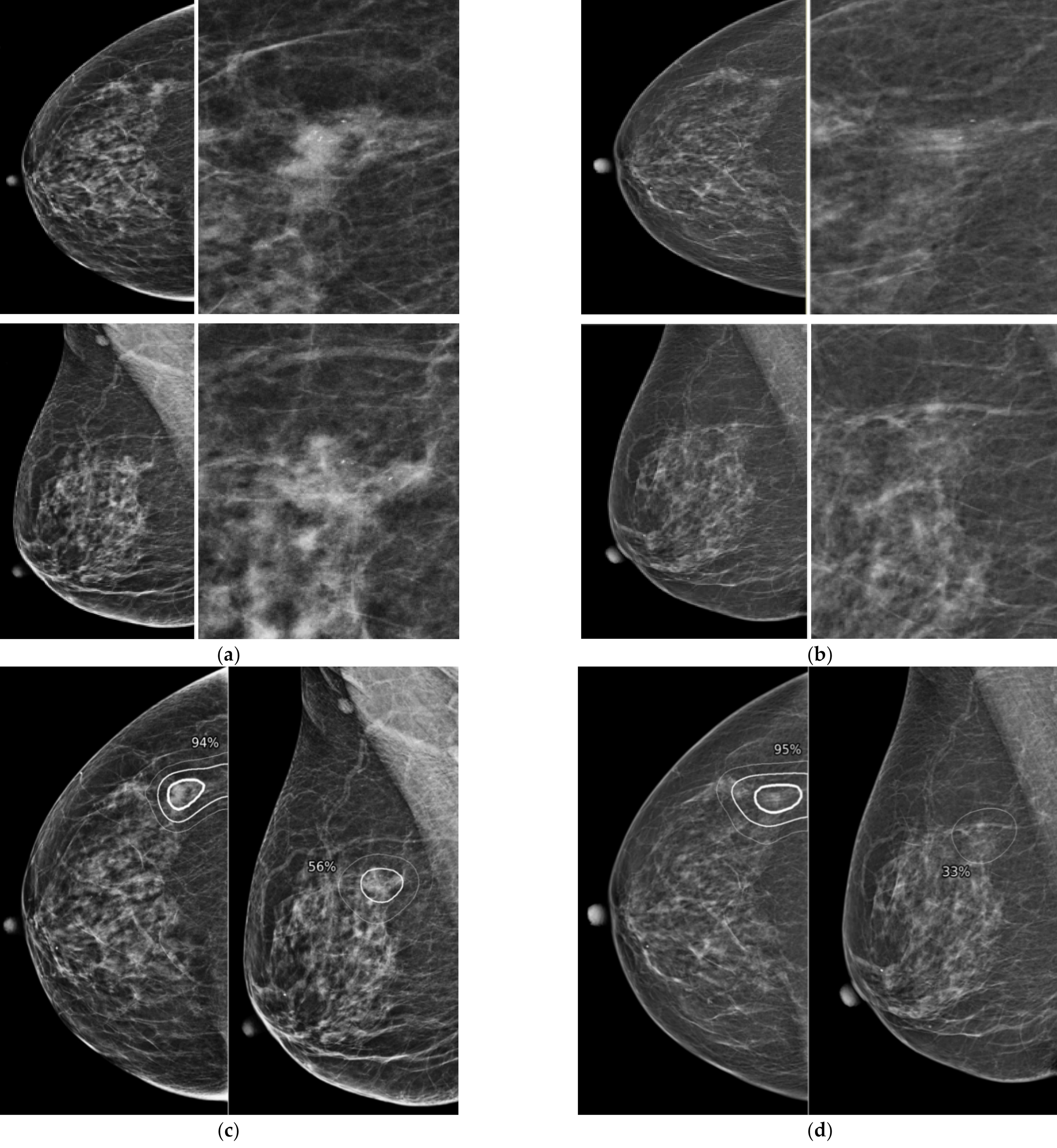 Diagnostics 12 00387 g002