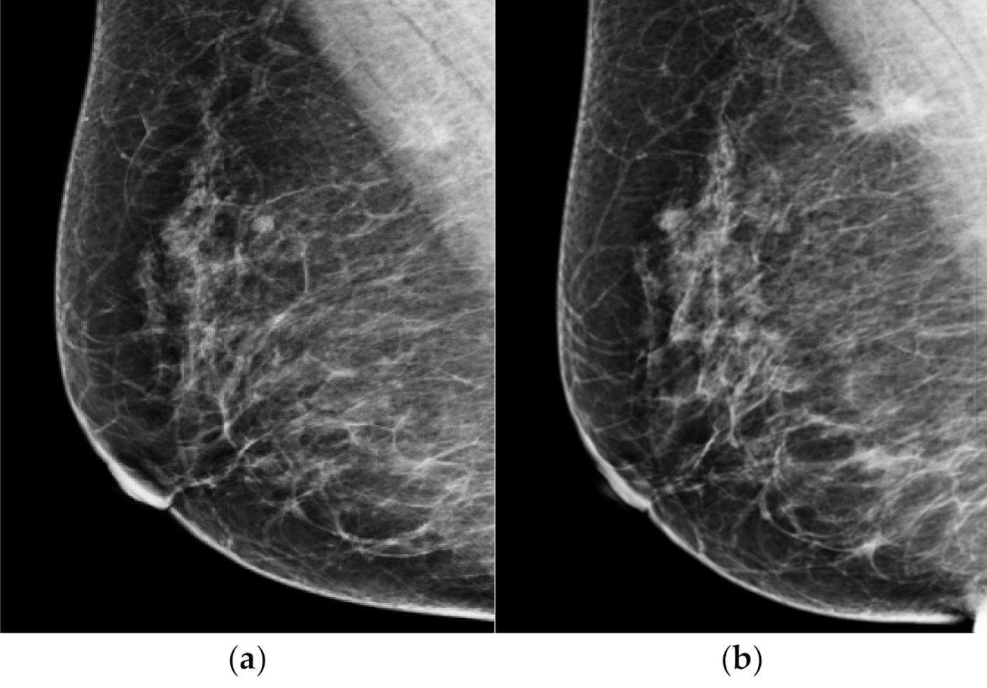 Diagnostics 12 00387 g003