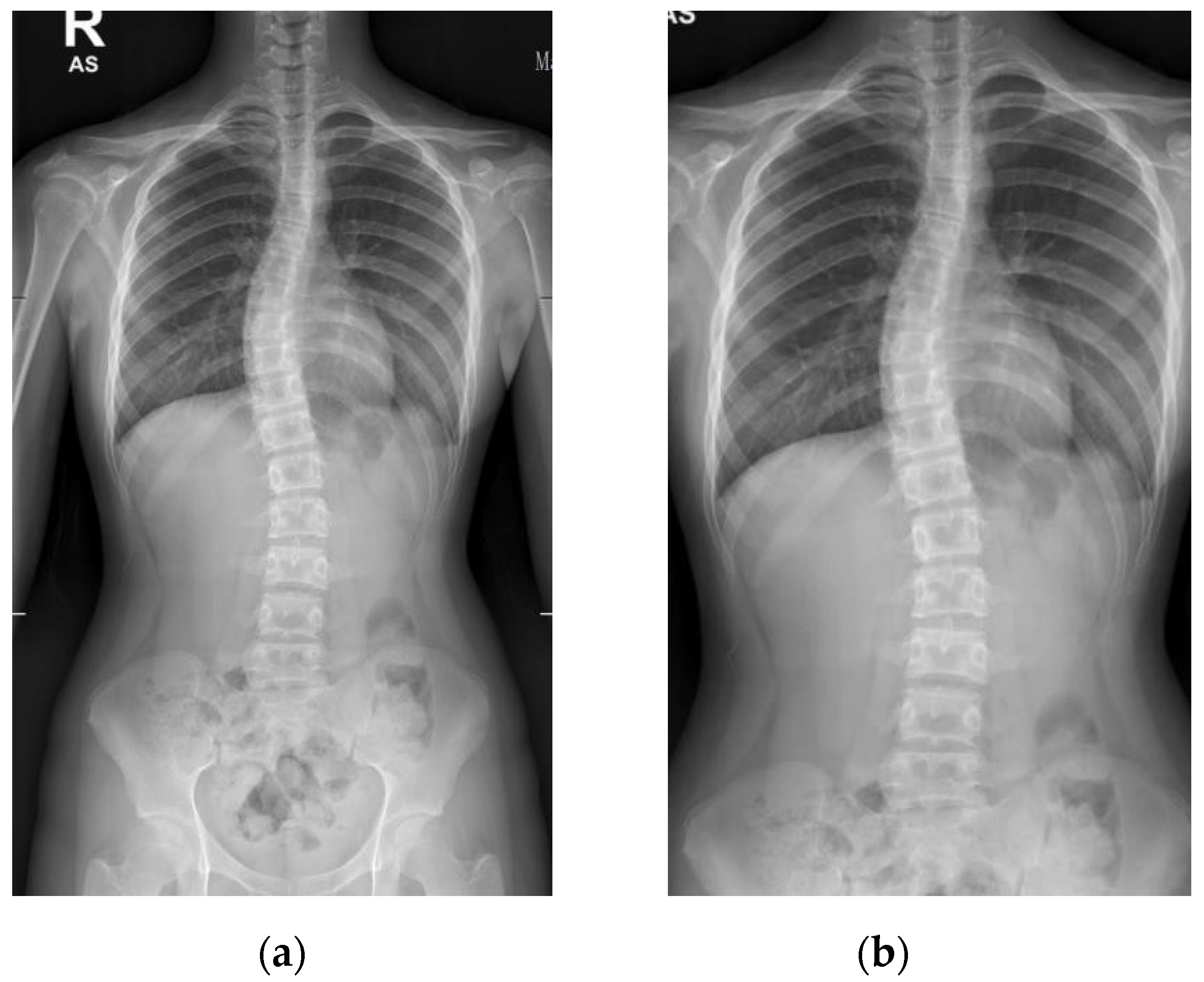Diagnostics 12 00396 g004