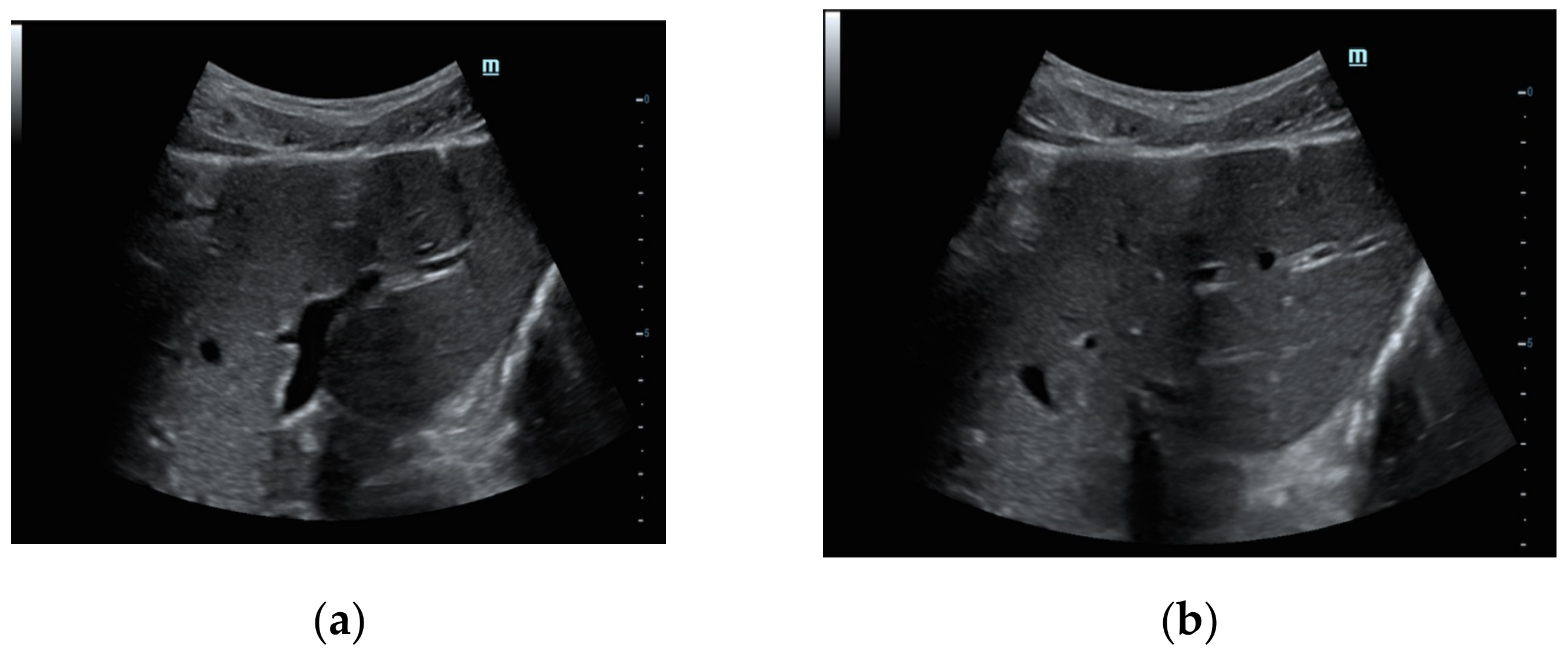 Diagnostics 12 00401 g002