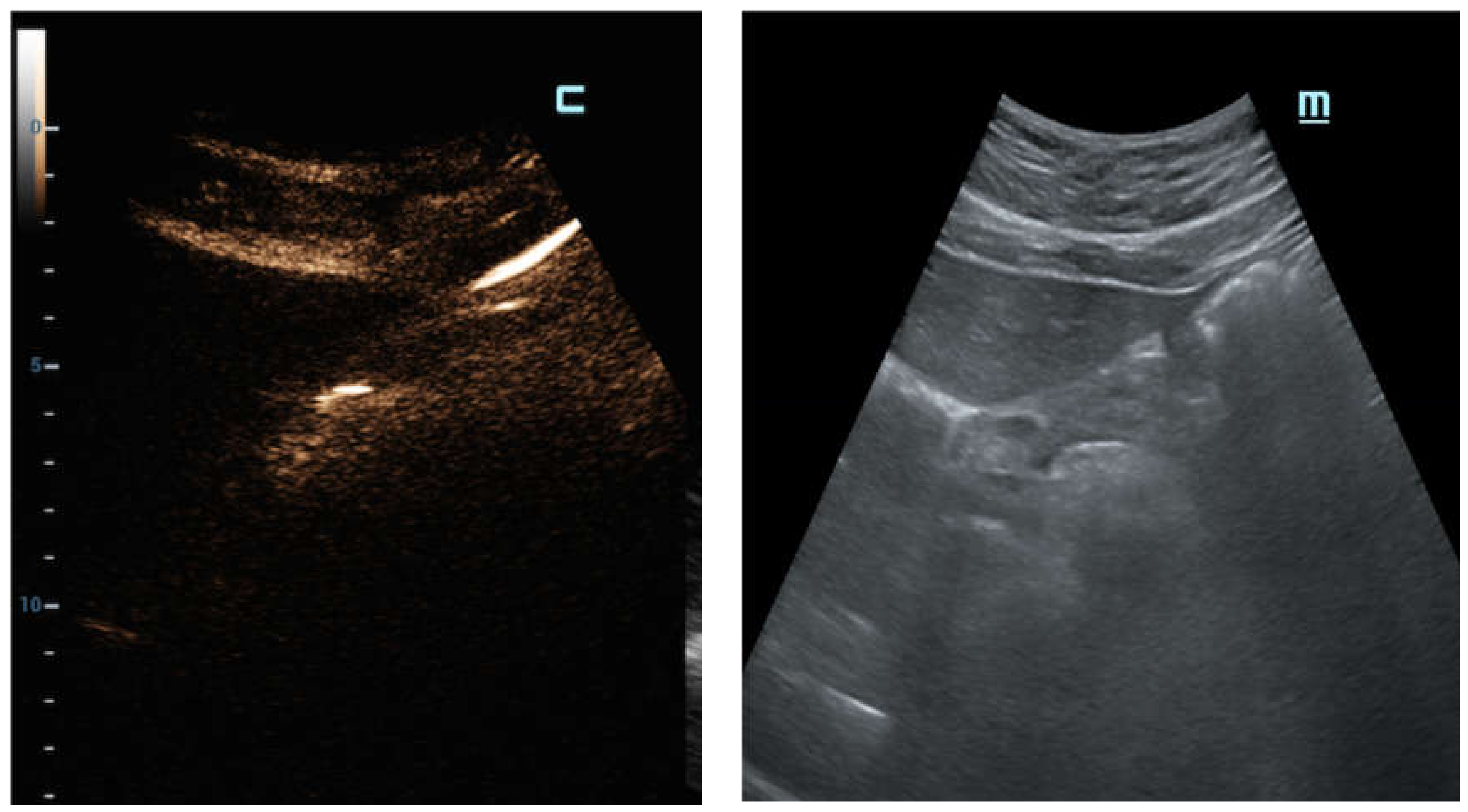 Diagnostics 12 00401 g003