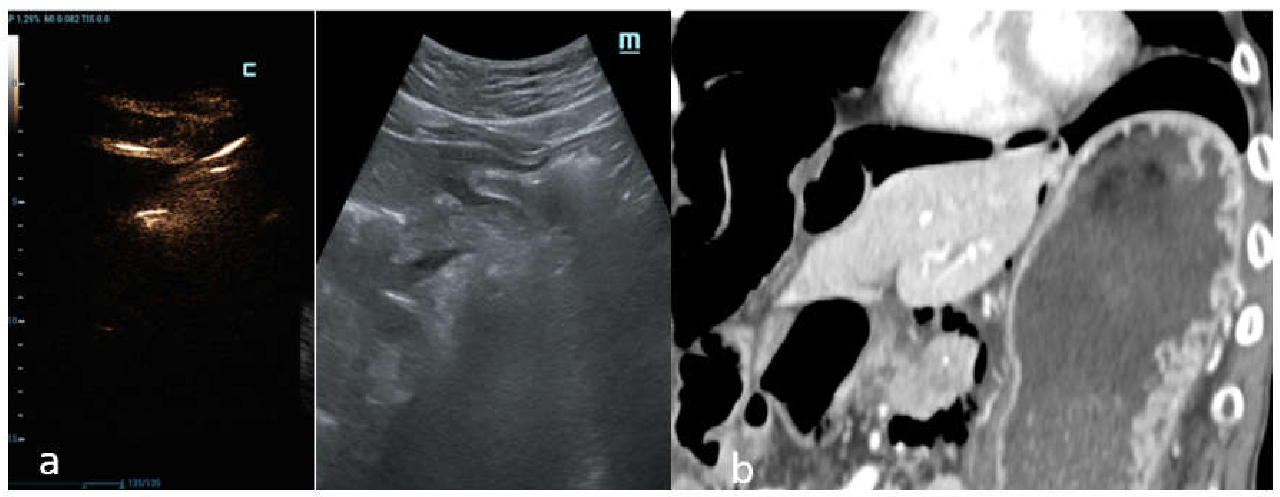 Diagnostics 12 00401 g004