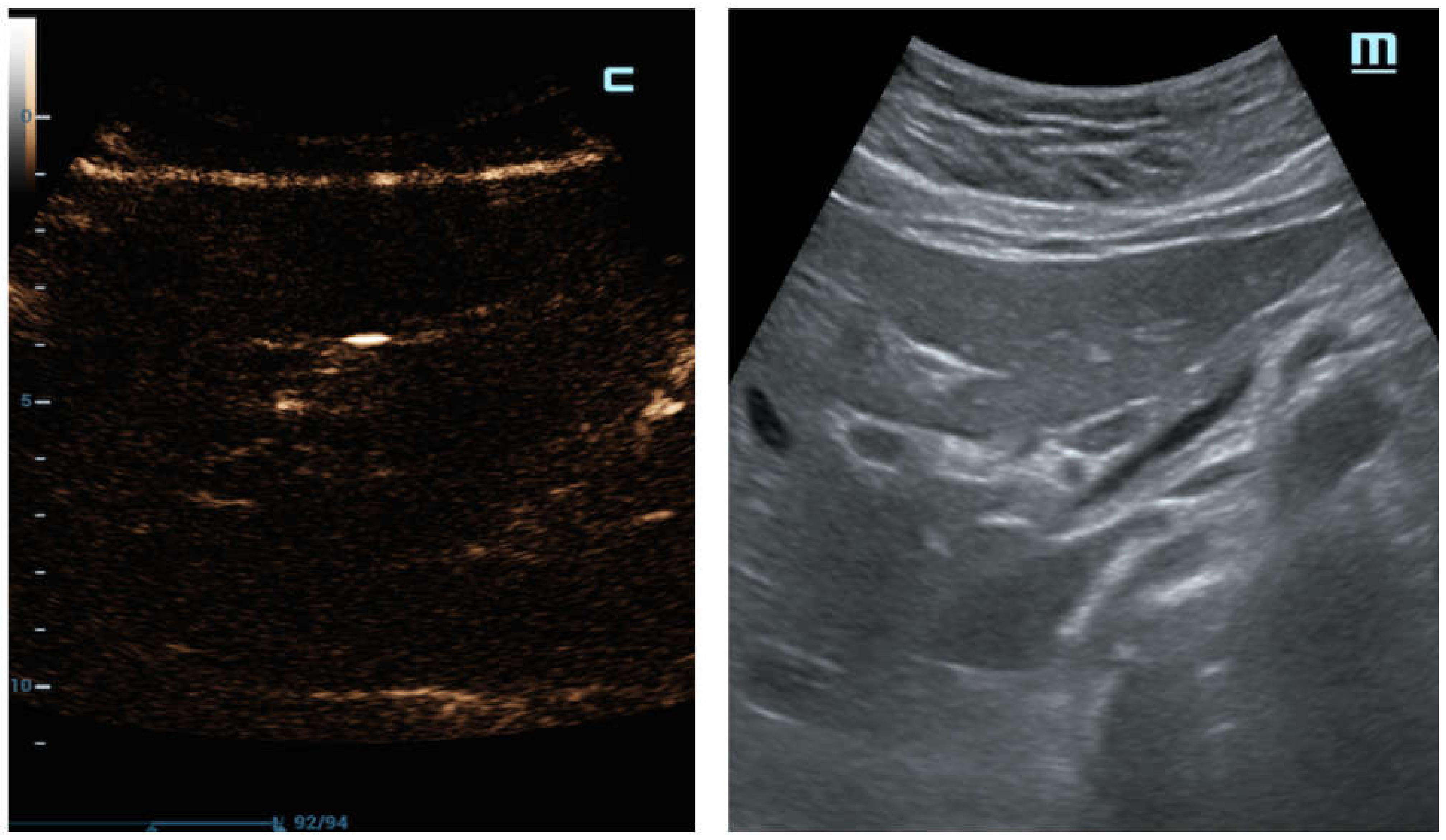 Diagnostics 12 00401 g007