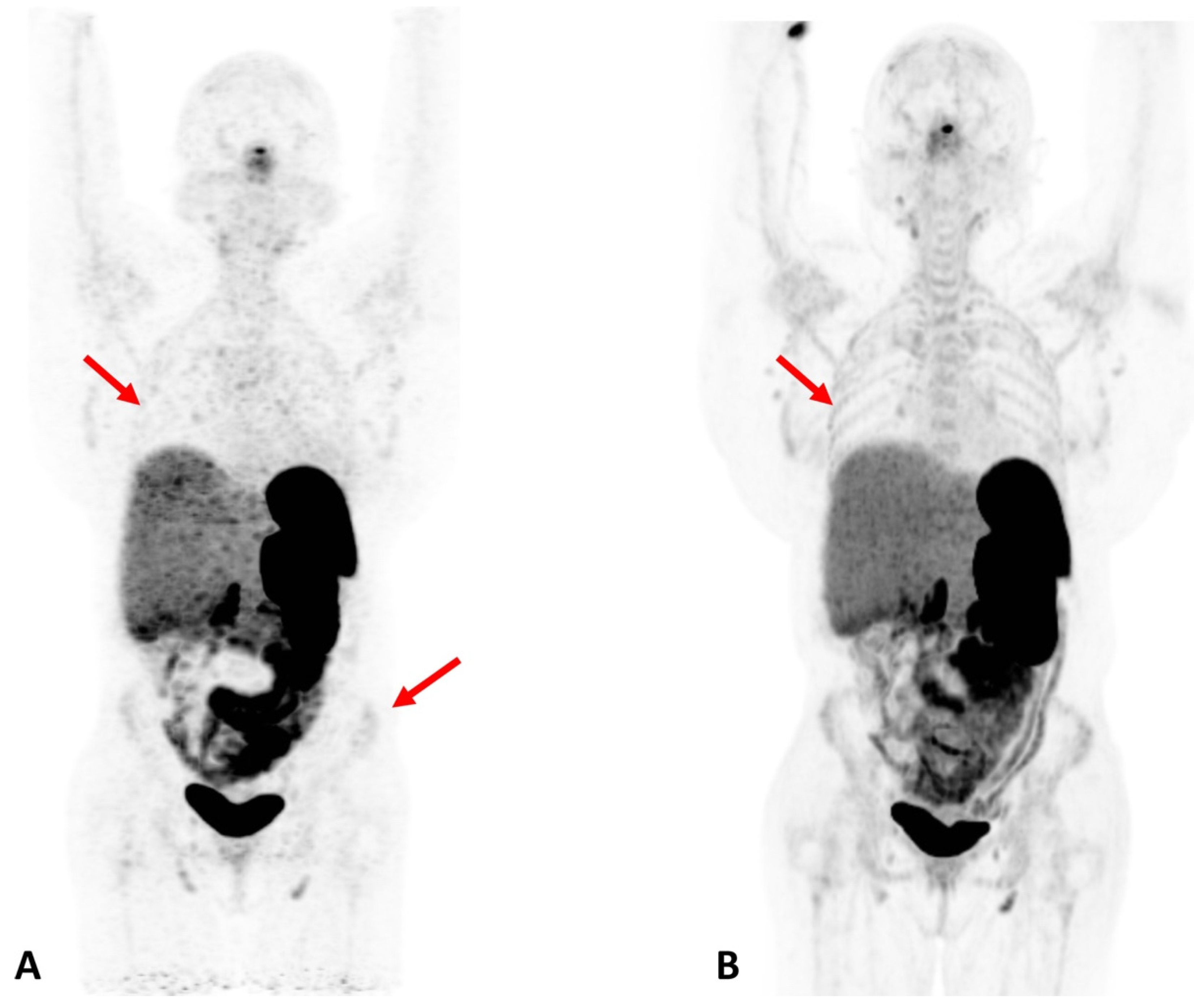 Diagnostics 12 00426 g004