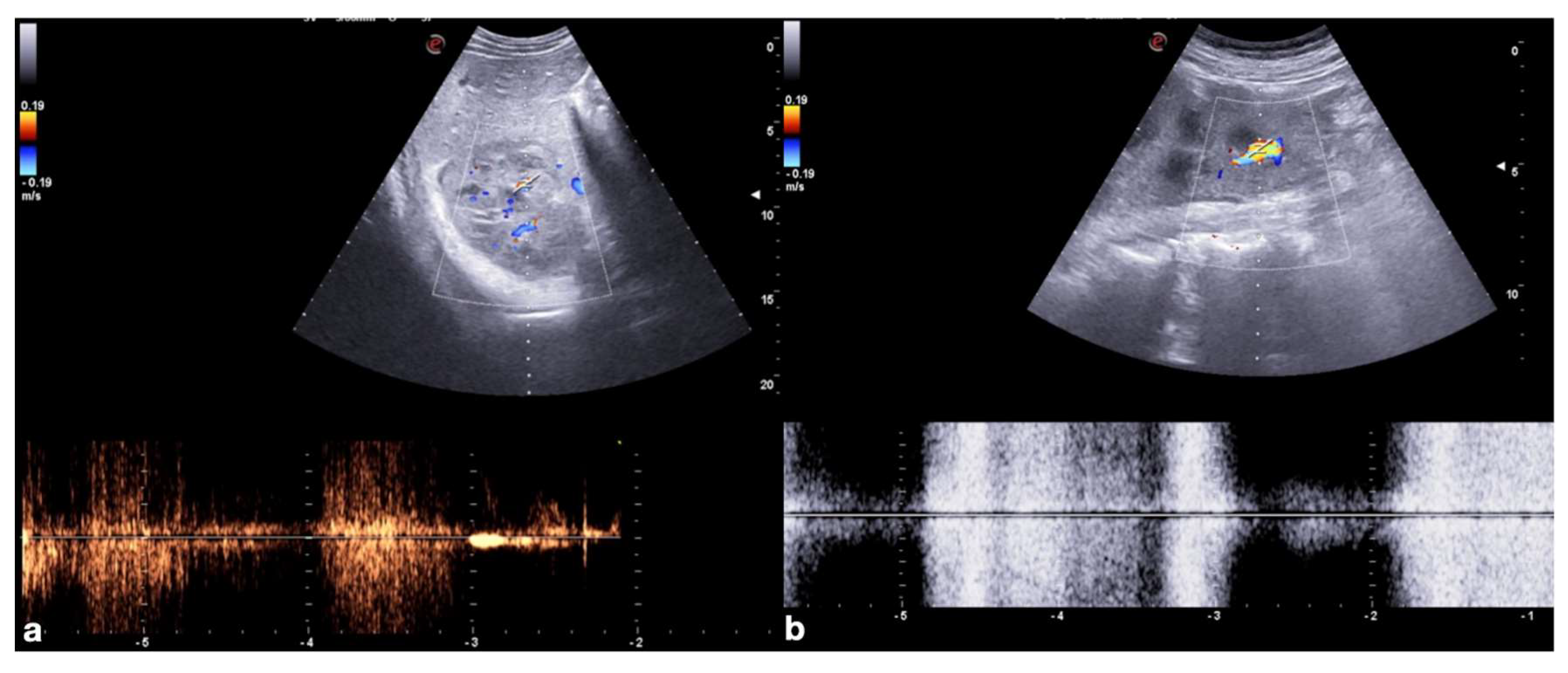 Diagnostics 12 00435 g002