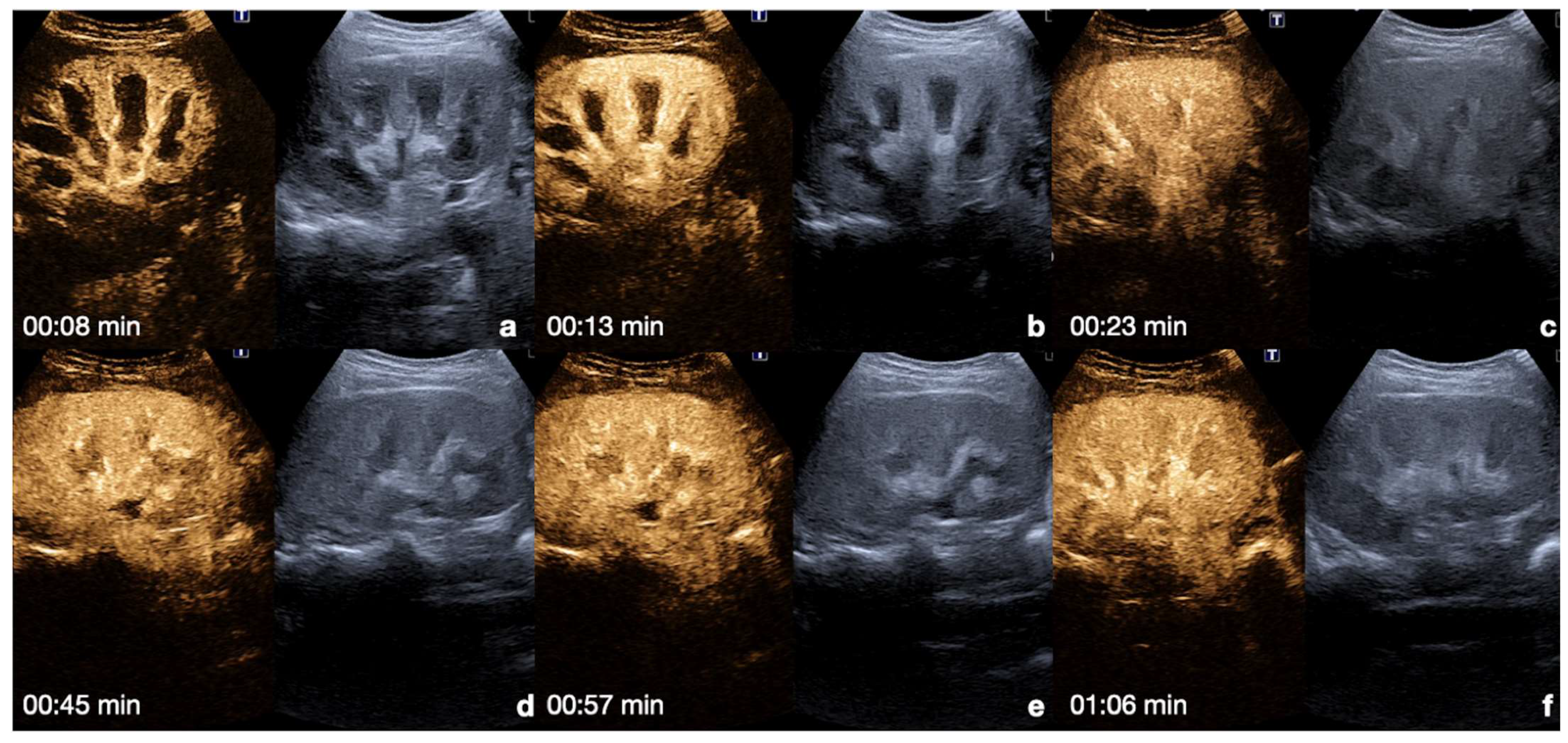 Diagnostics 12 00435 g004