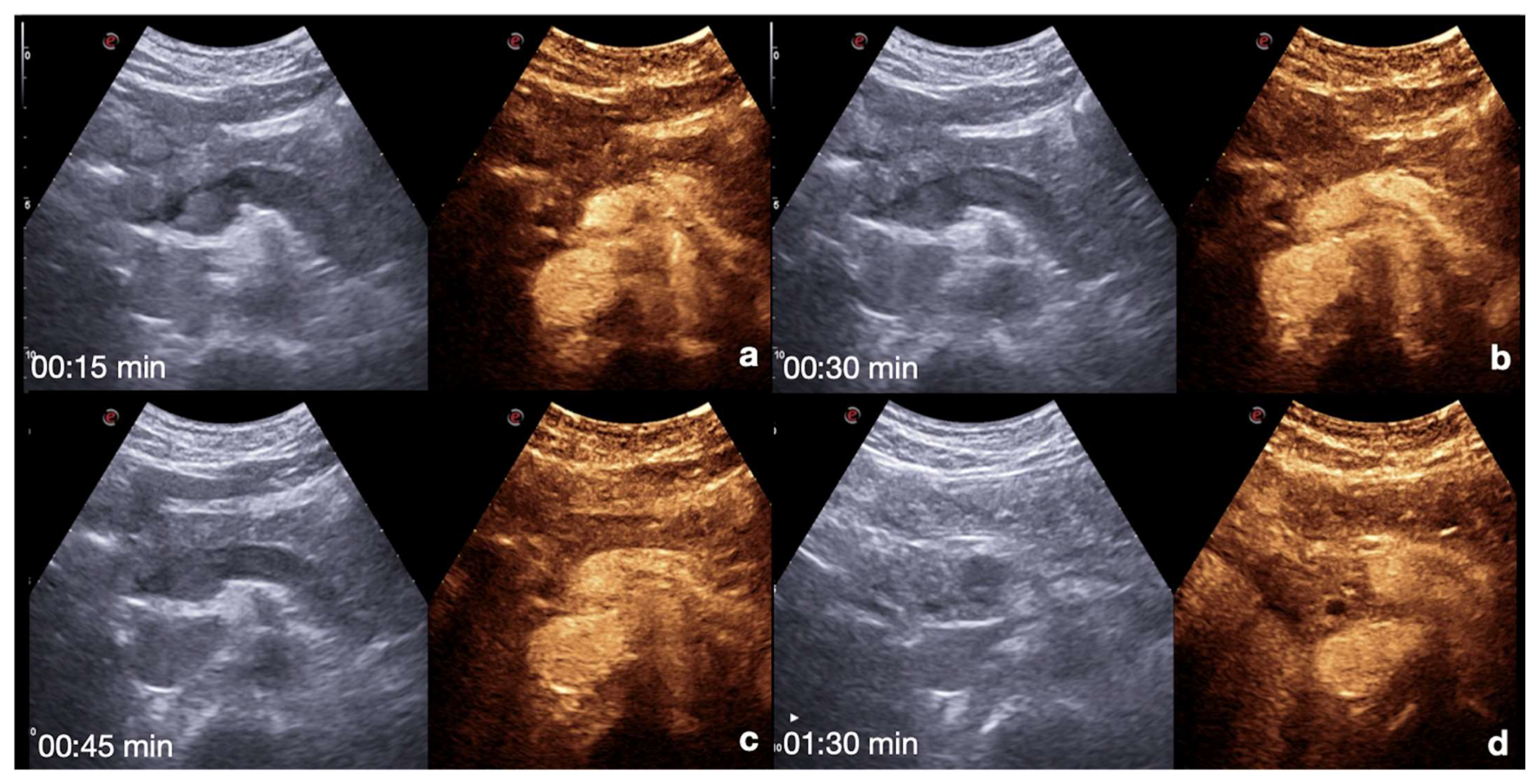 Diagnostics 12 00435 g006