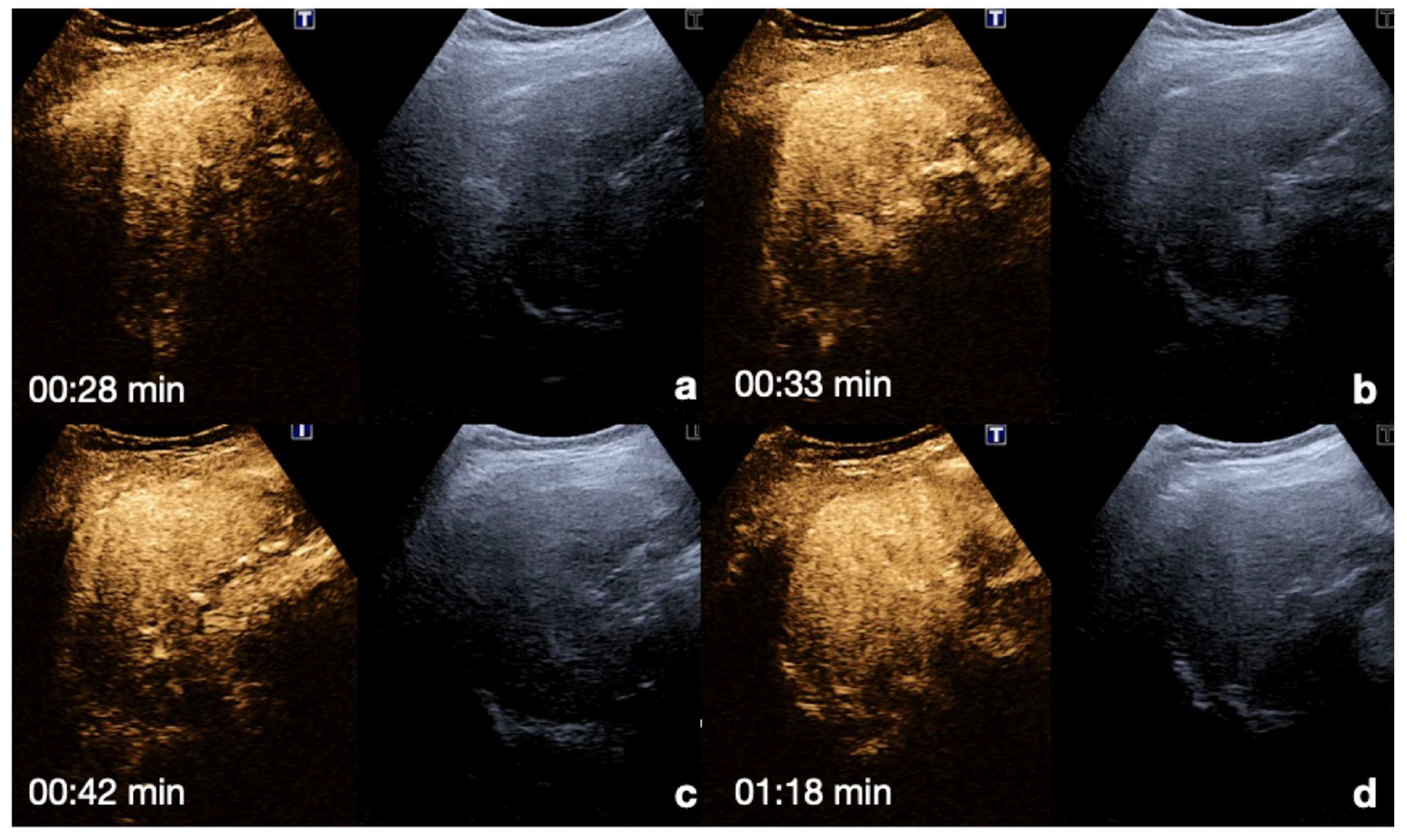 Diagnostics 12 00435 g007