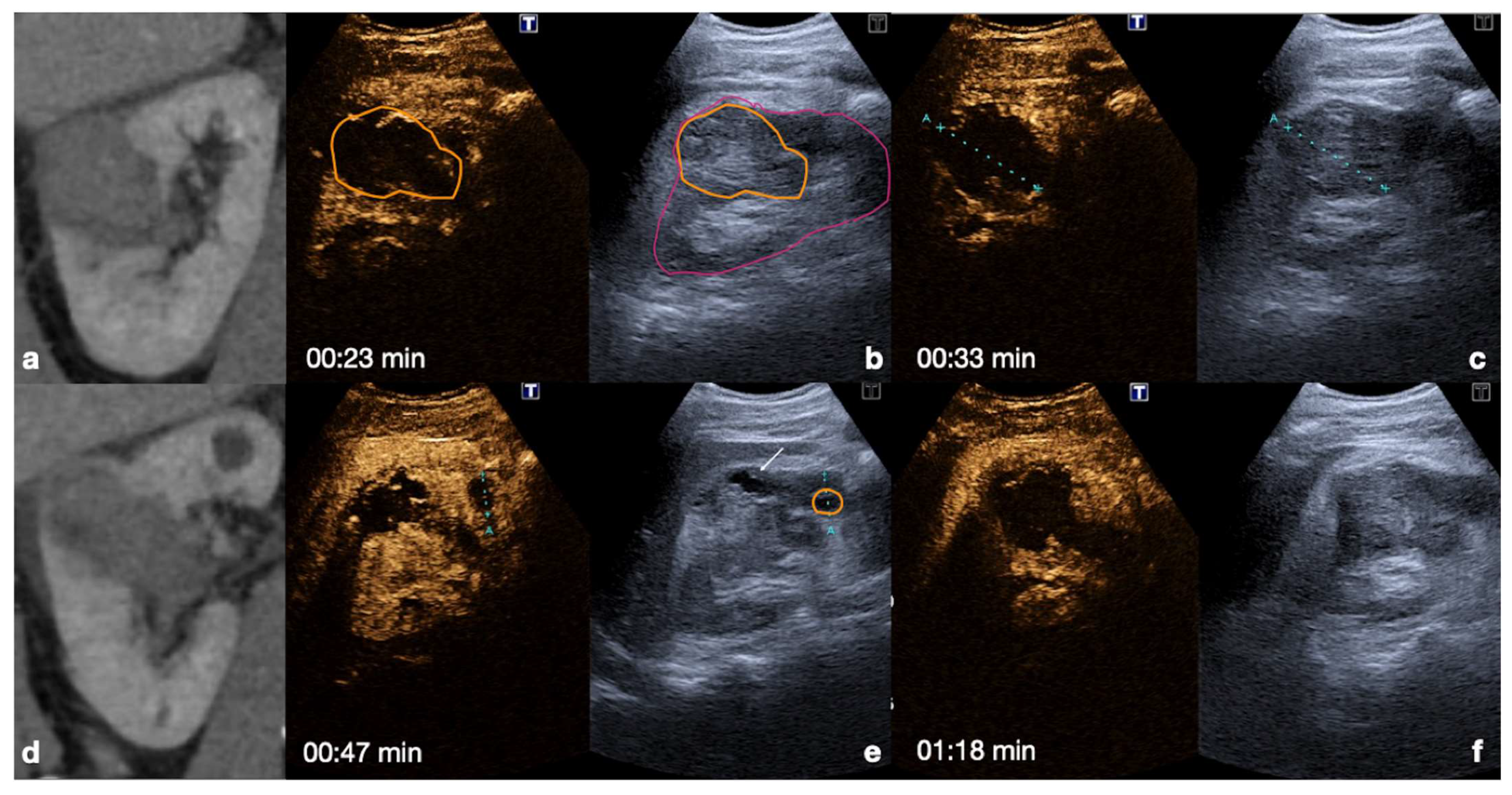 Diagnostics 12 00435 g010