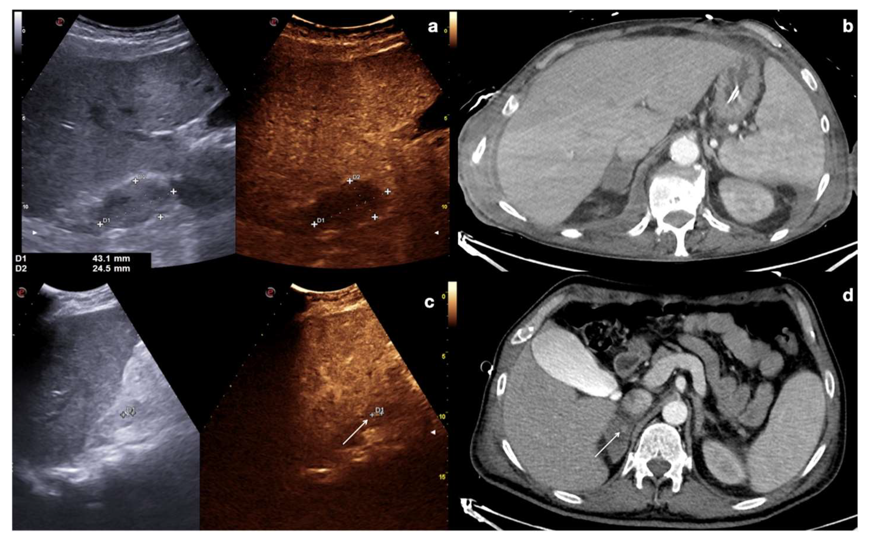Diagnostics 12 00435 g011