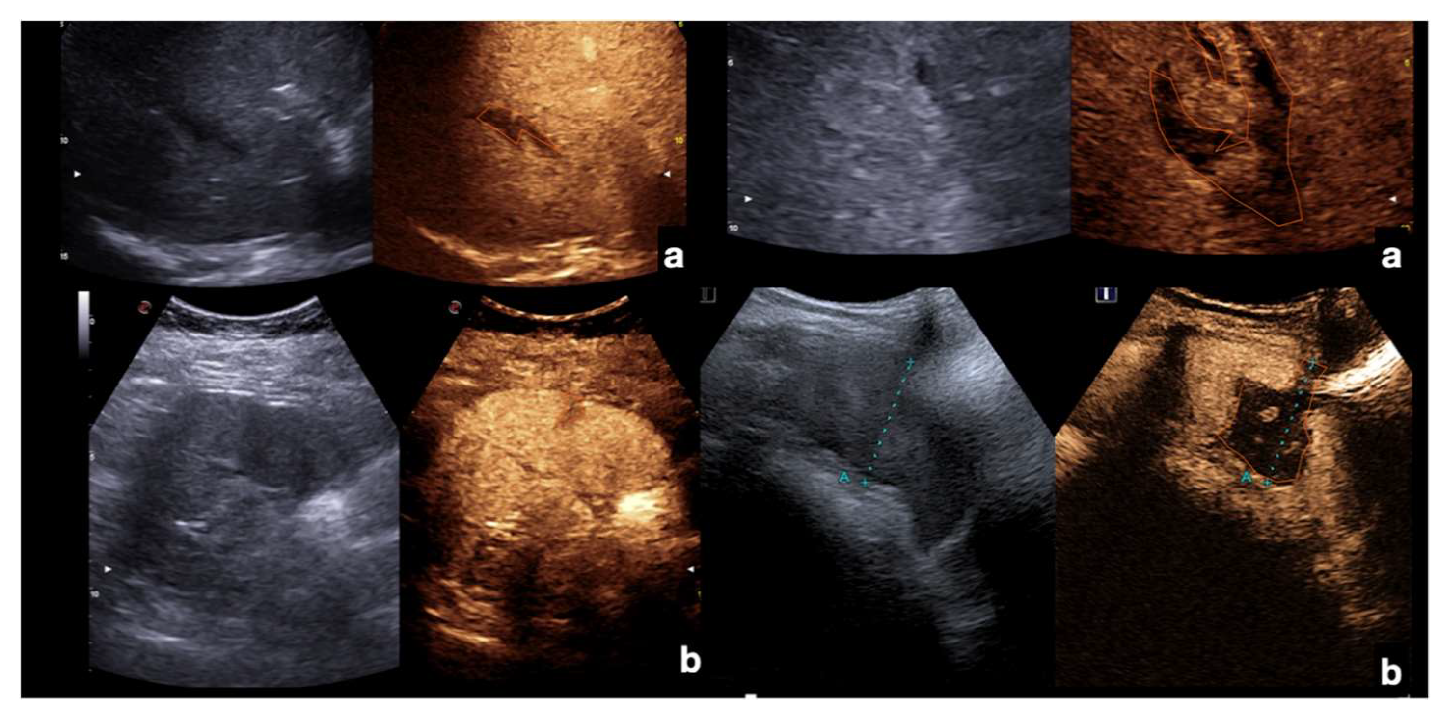 Diagnostics 12 00435 g012