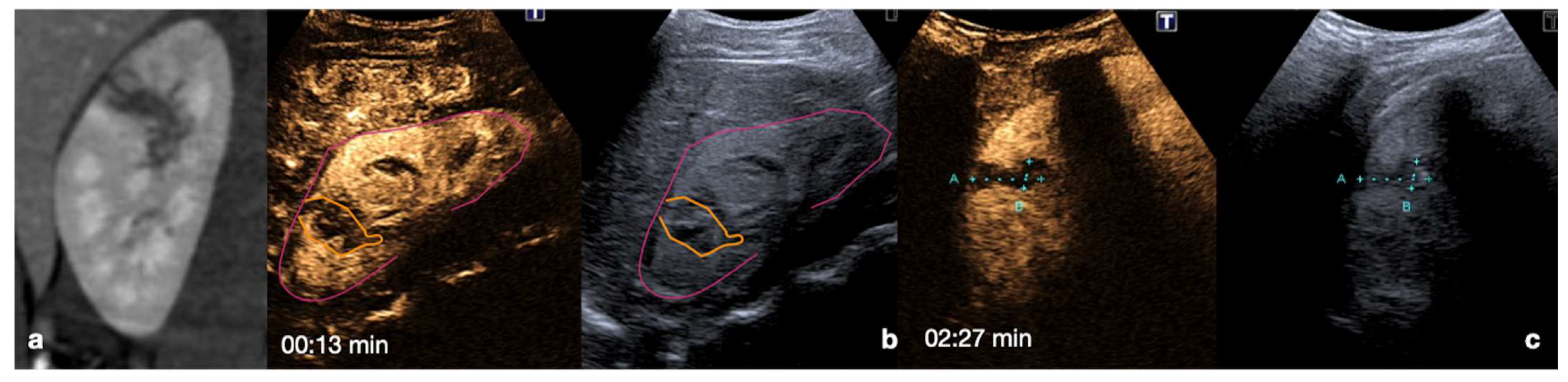 Diagnostics 12 00435 g013