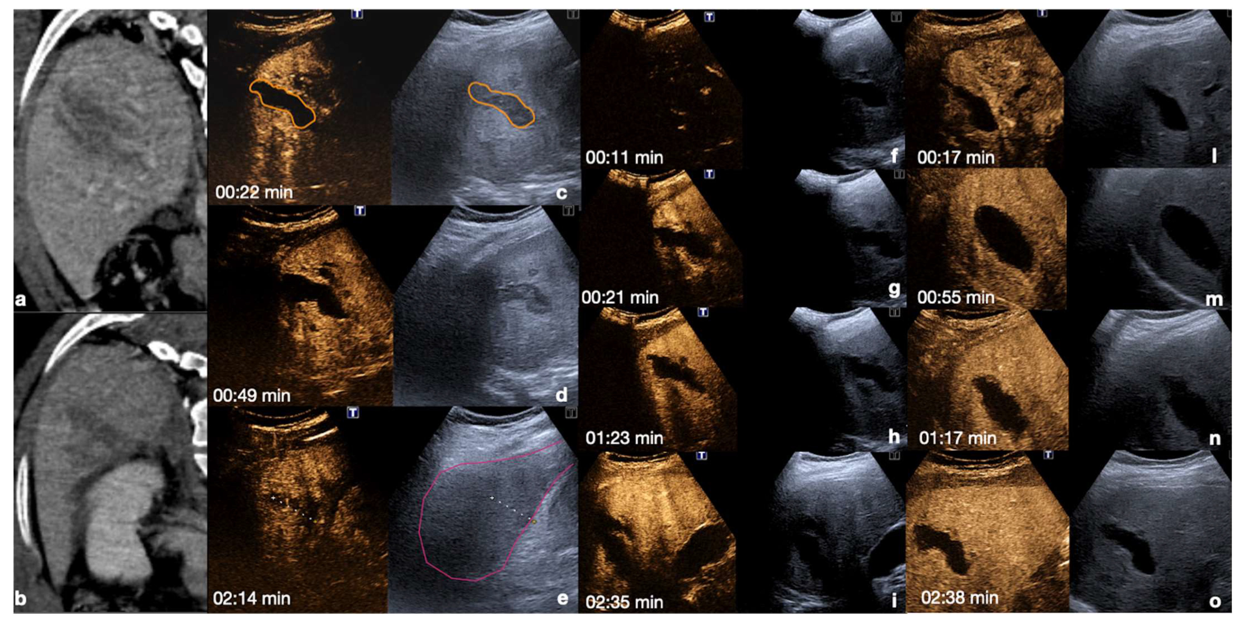 Diagnostics 12 00435 g014