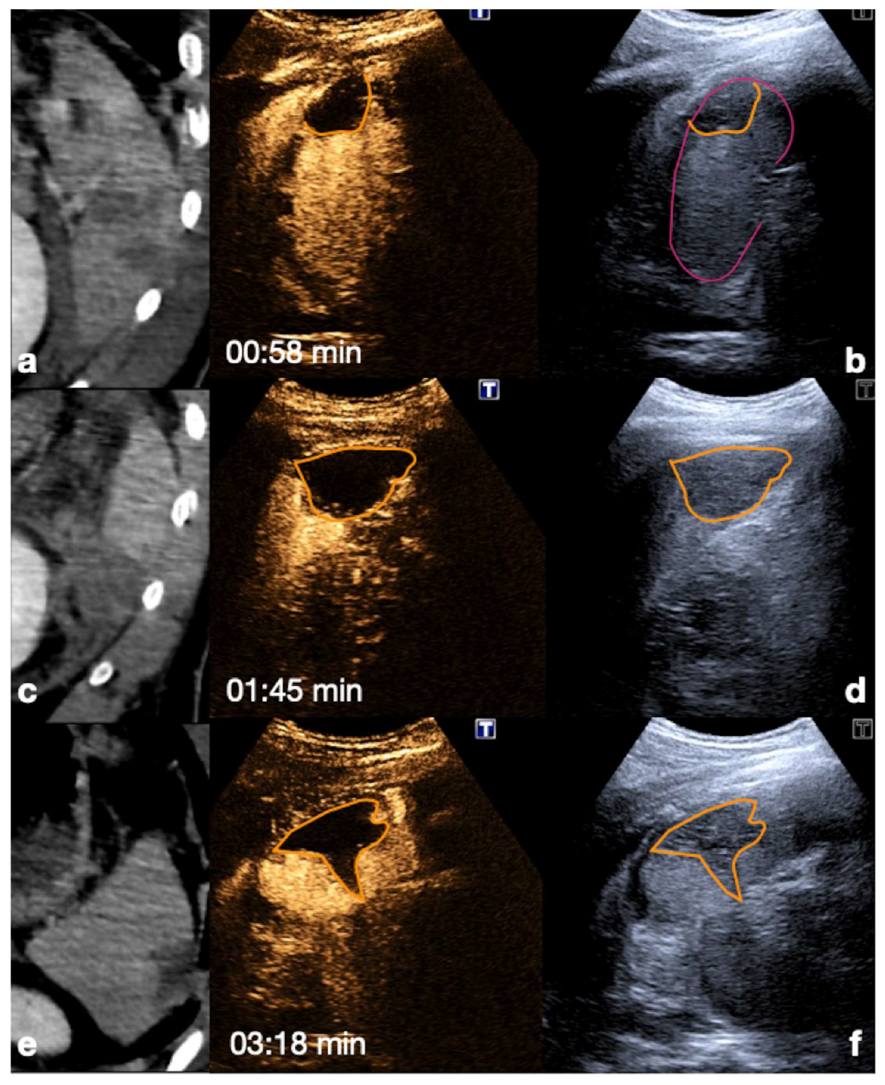 Diagnostics 12 00435 g015