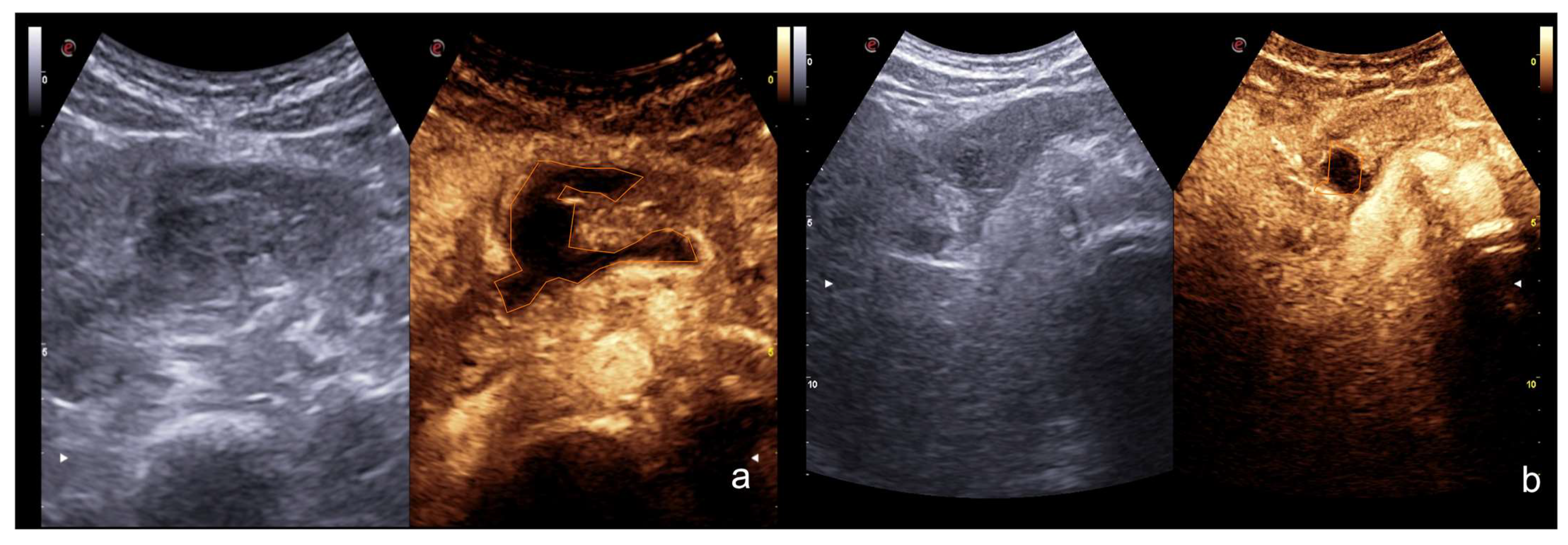 Diagnostics 12 00435 g016