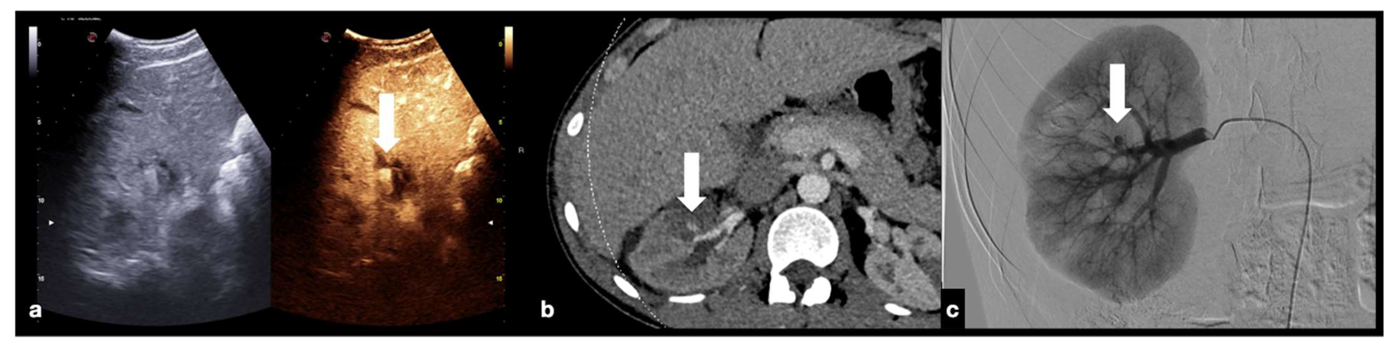 Diagnostics 12 00435 g020
