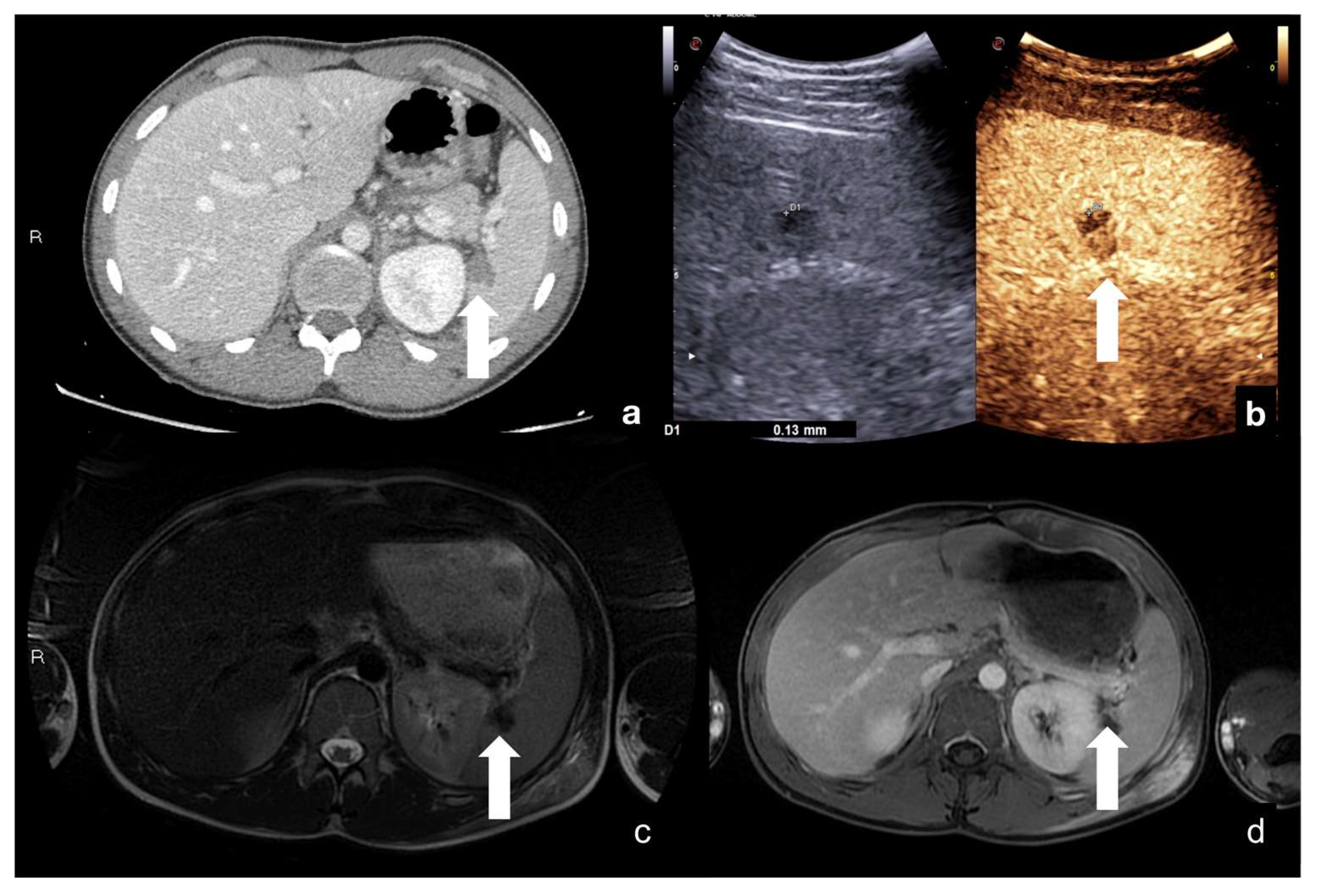 Diagnostics 12 00435 g022