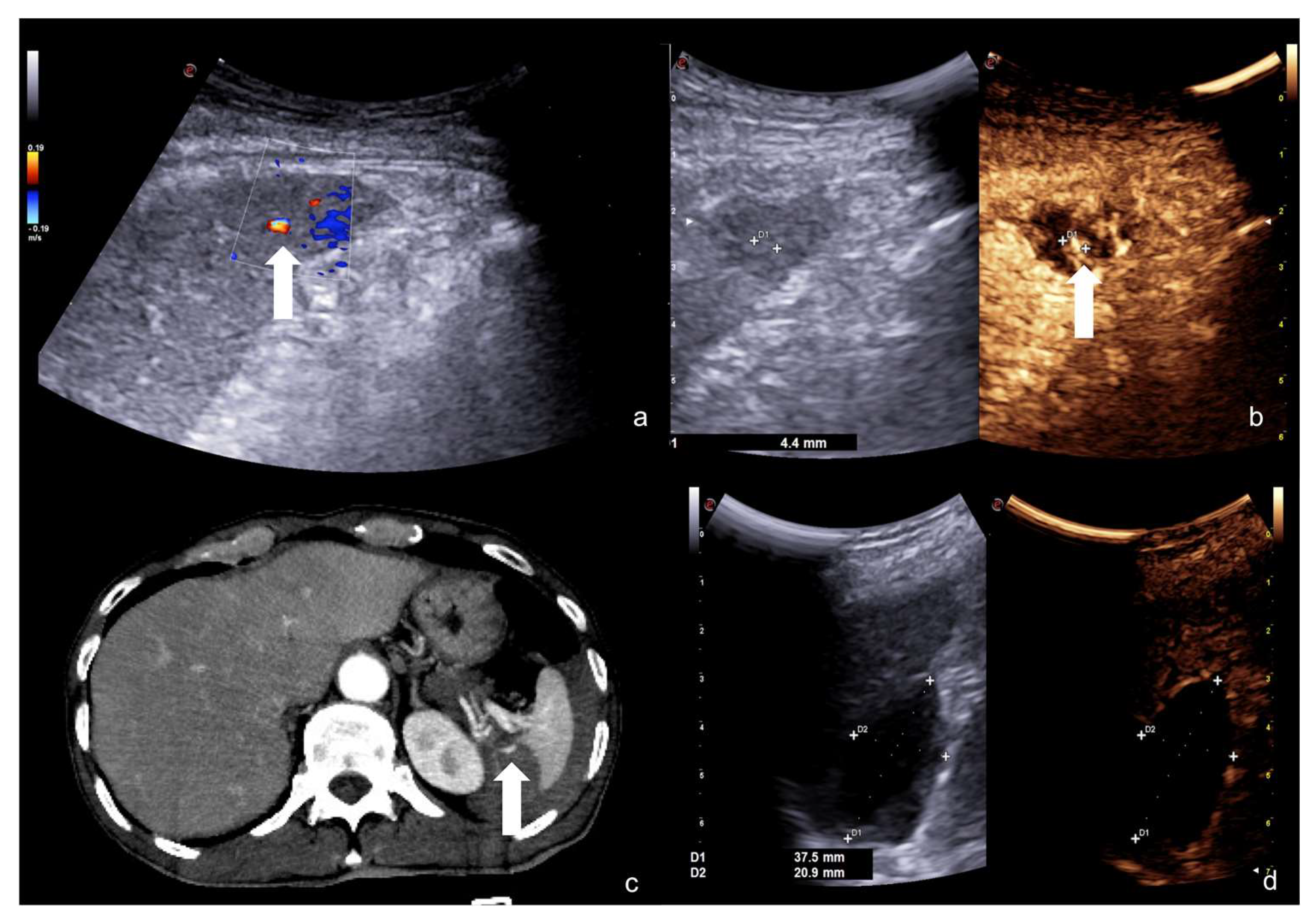 Diagnostics 12 00435 g024