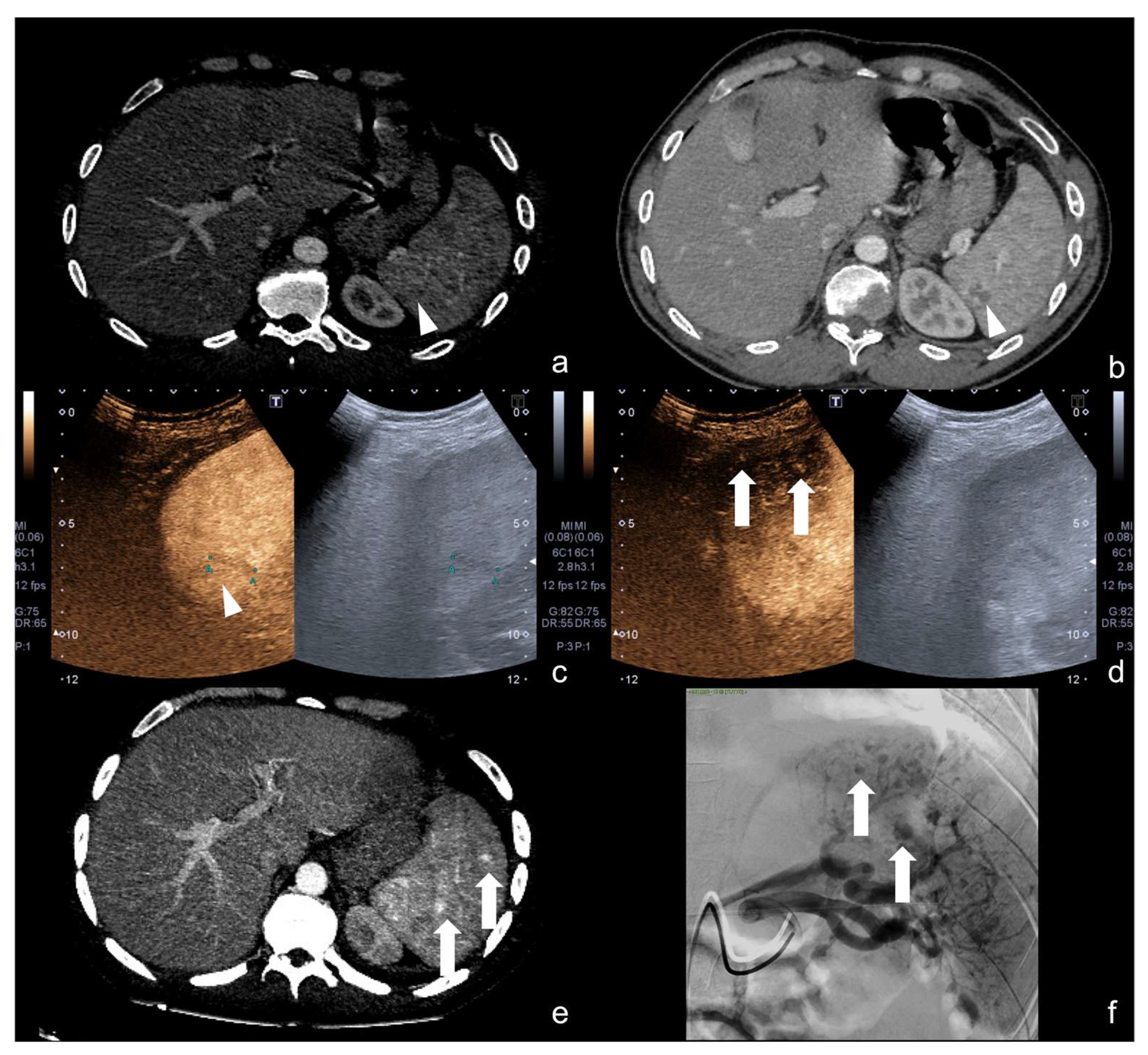 Diagnostics 12 00435 g025