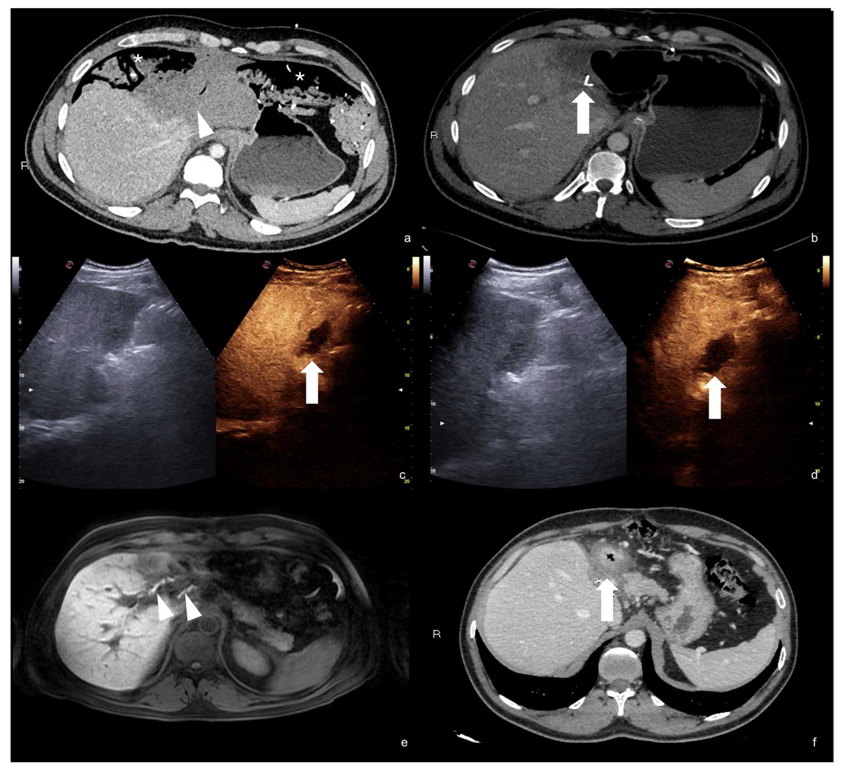 Diagnostics 12 00435 g027
