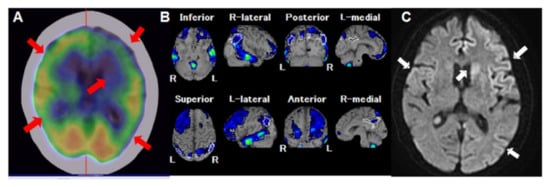 Diagnostics 12 00437 g001 550