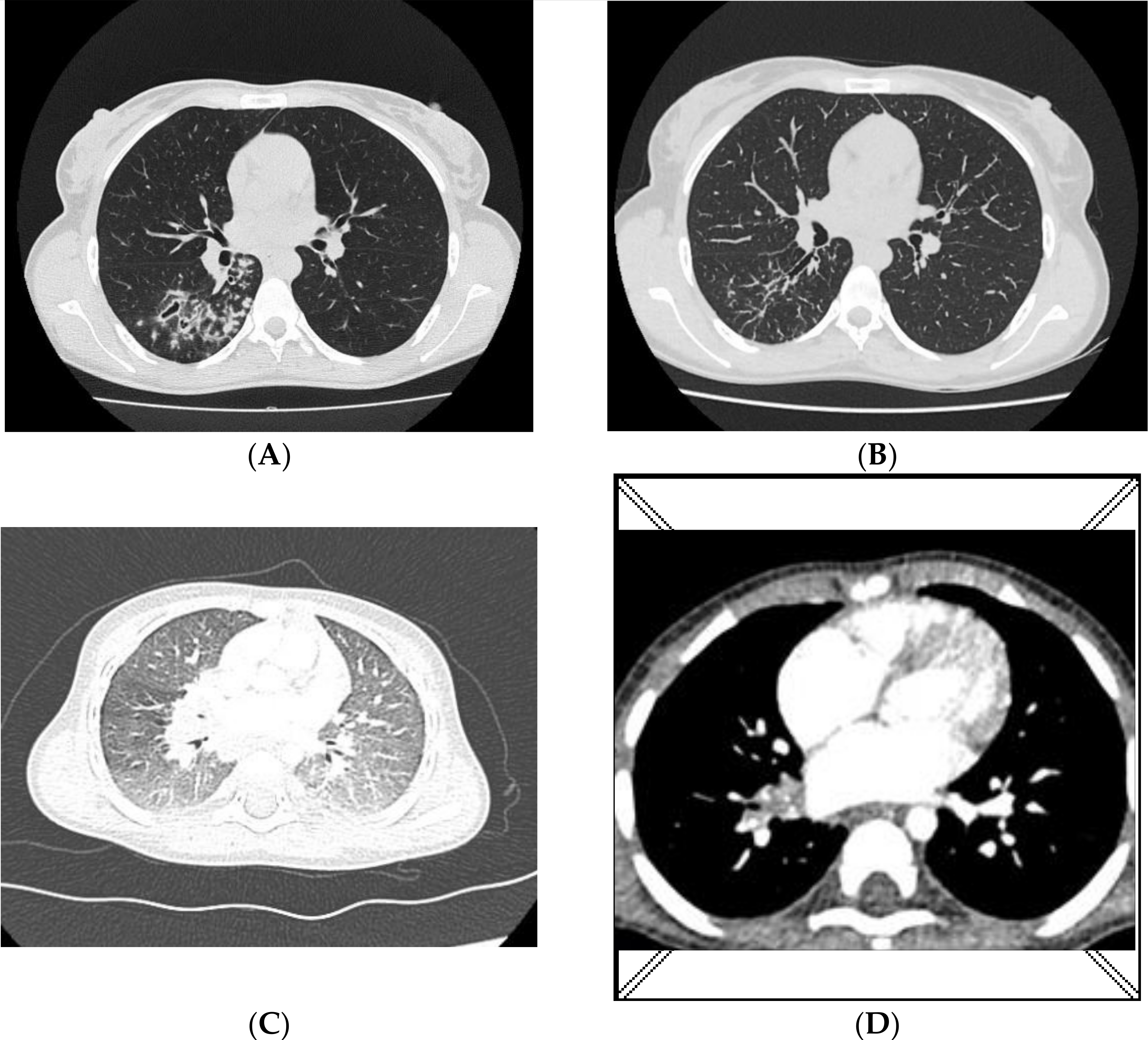 Diagnostics 12 00438 g001