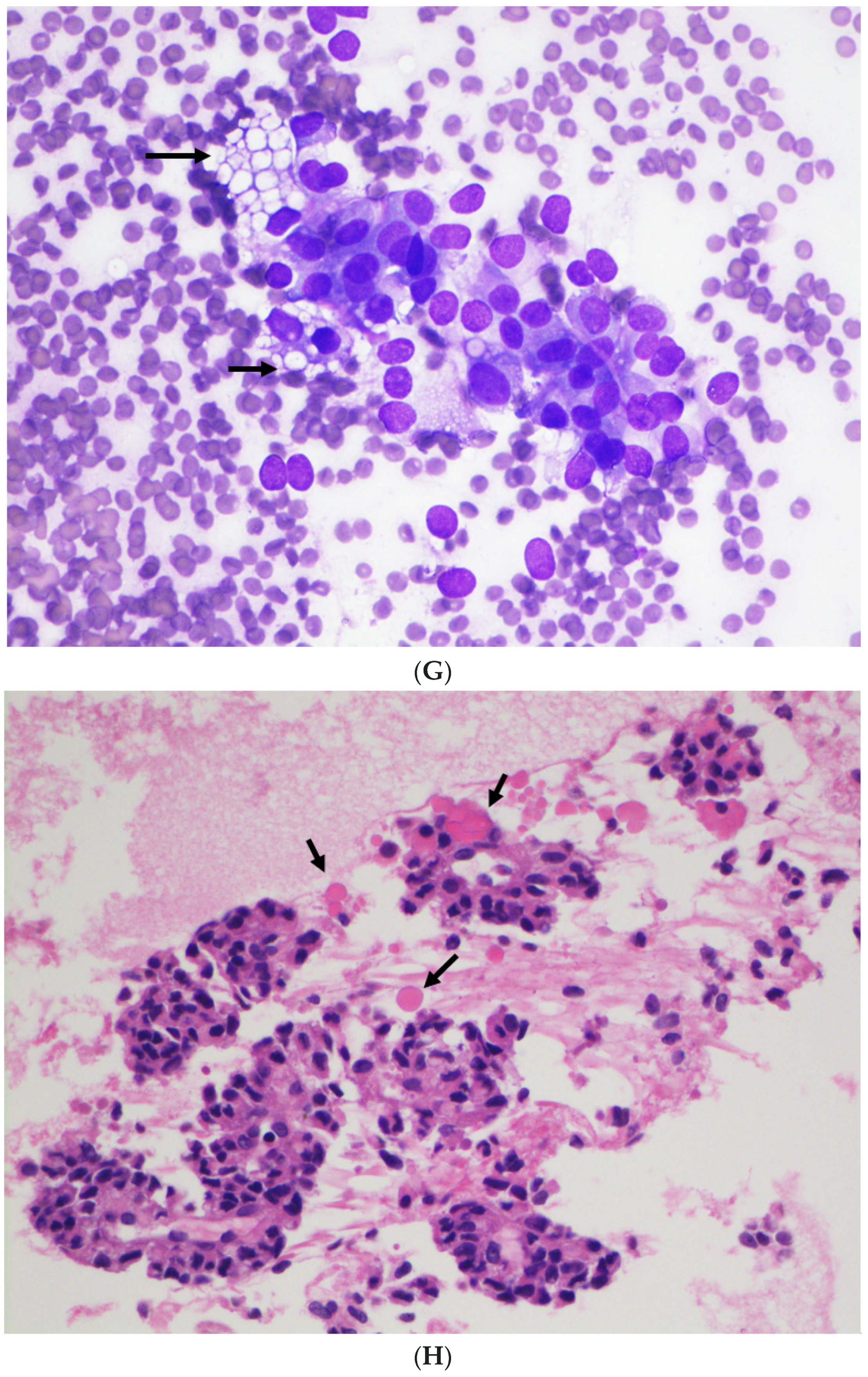 Diagnostics 12 00449 g001d