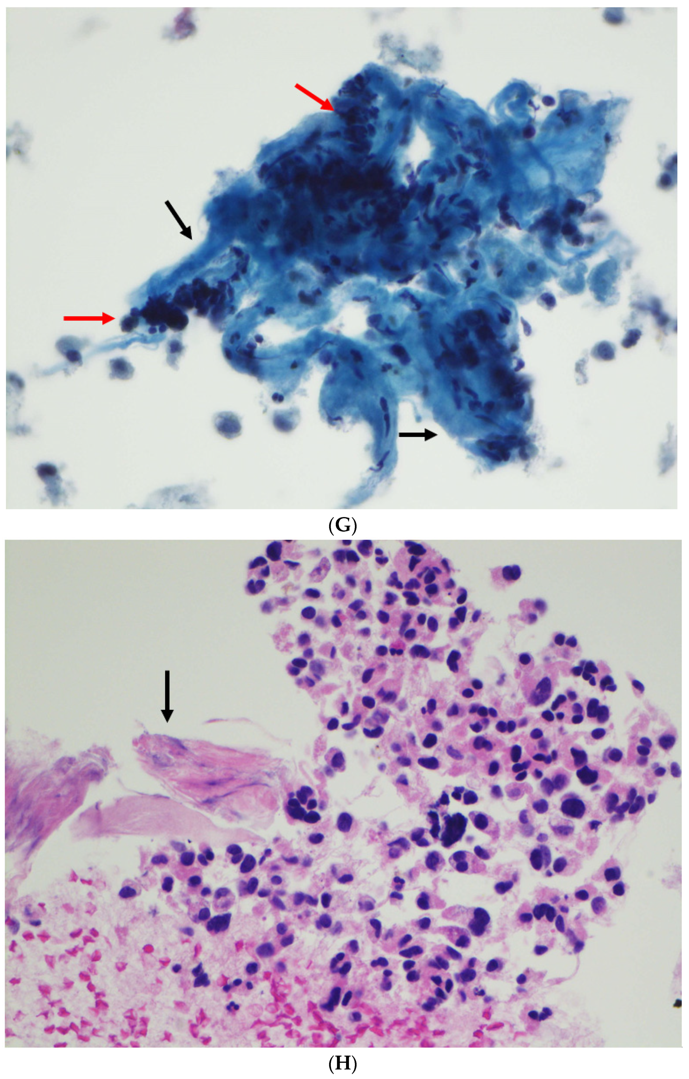 Diagnostics 12 00449 g002d