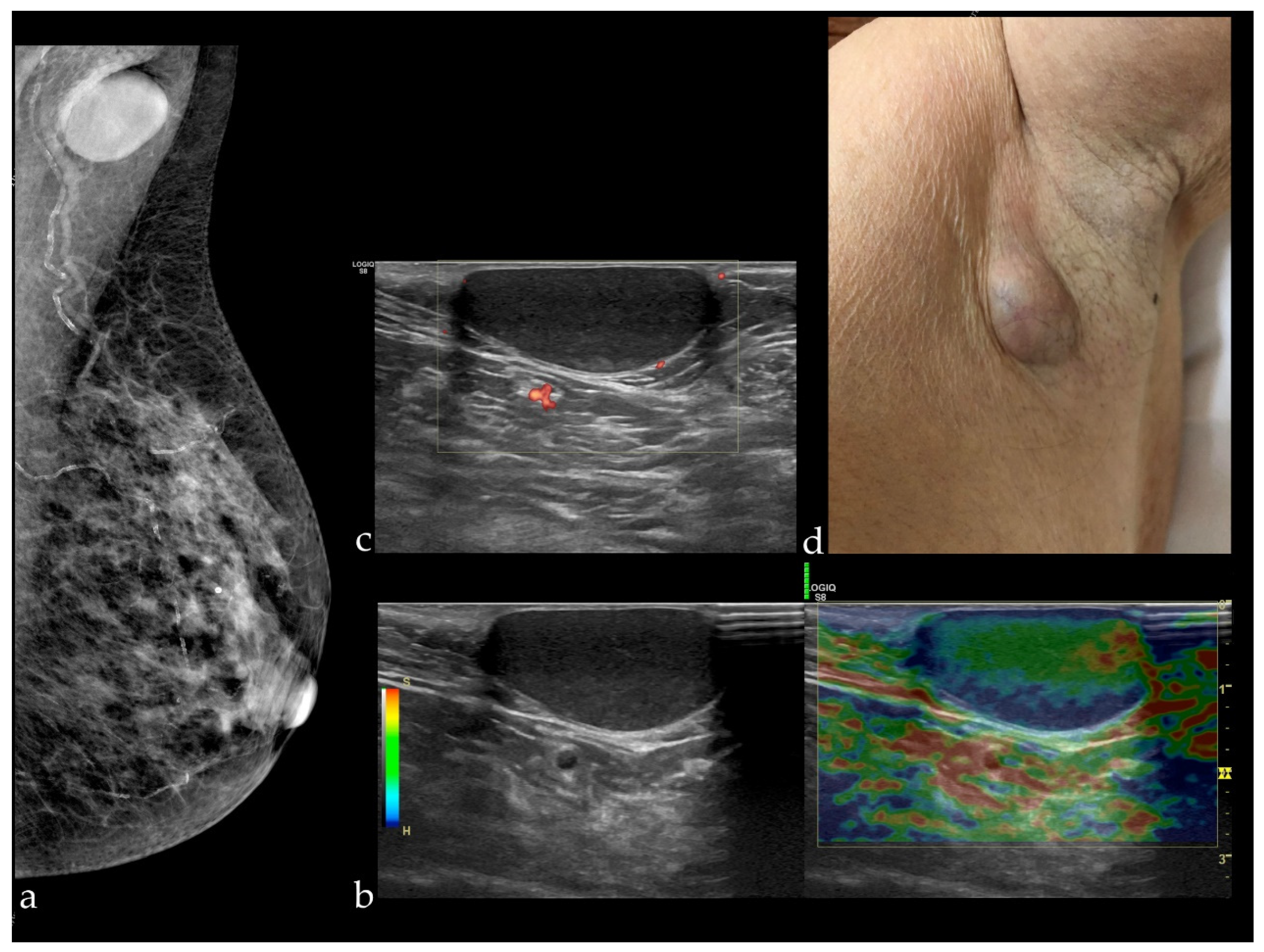 Diagnostics 12 00459 g003