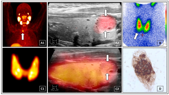 Diagnostics 12 00472 g001