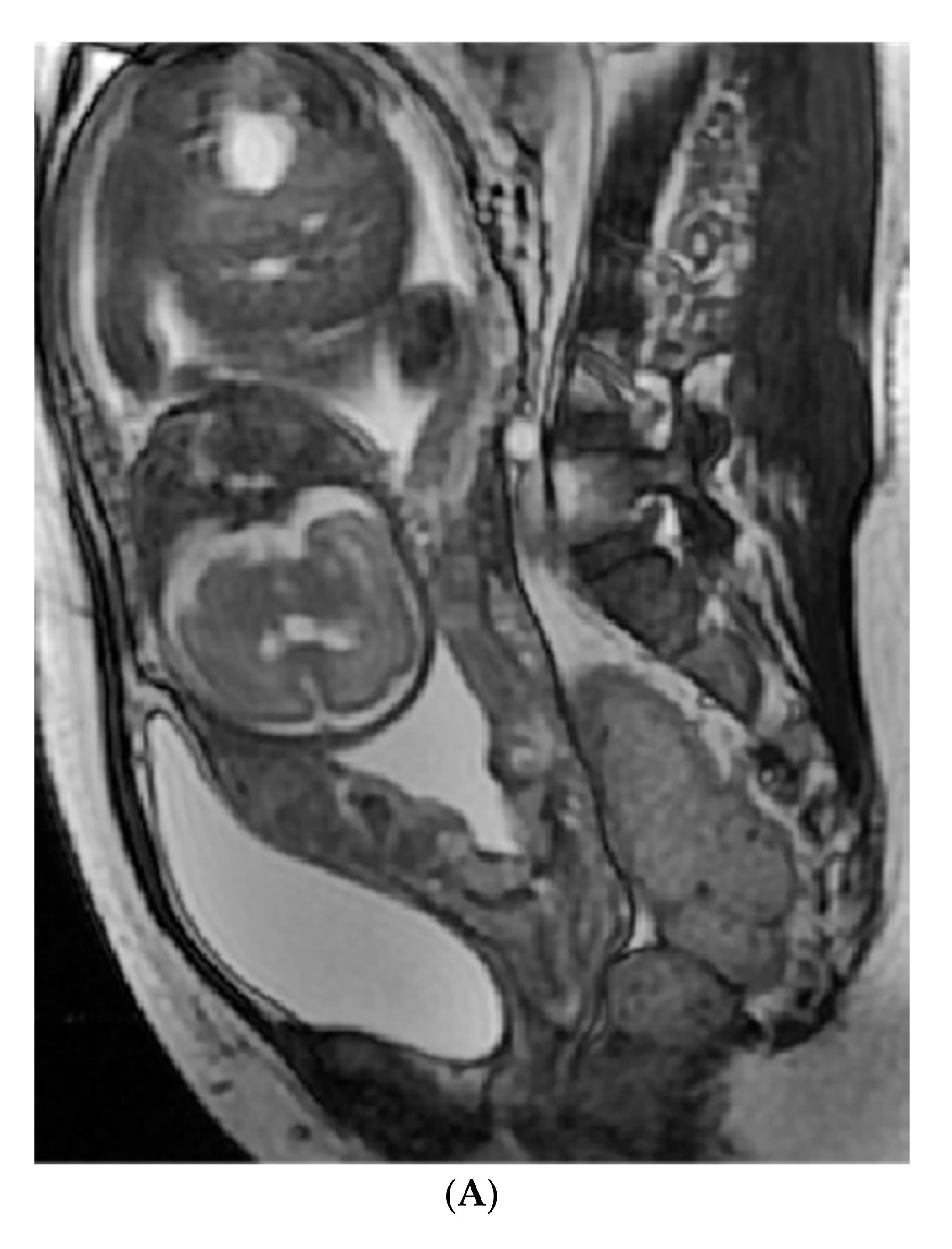 Diagnostics 12 00485 g005a