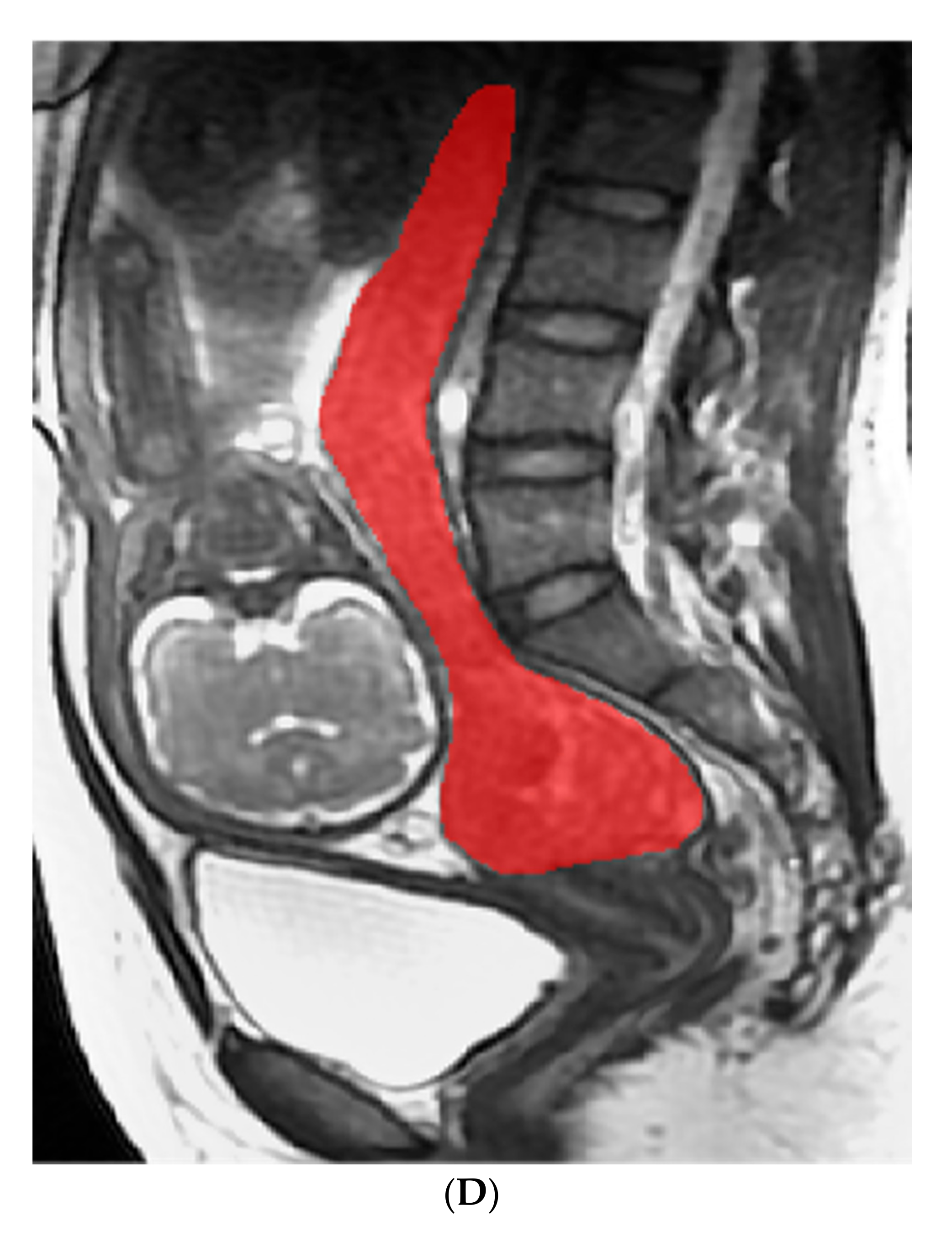 Diagnostics 12 00485 g005c