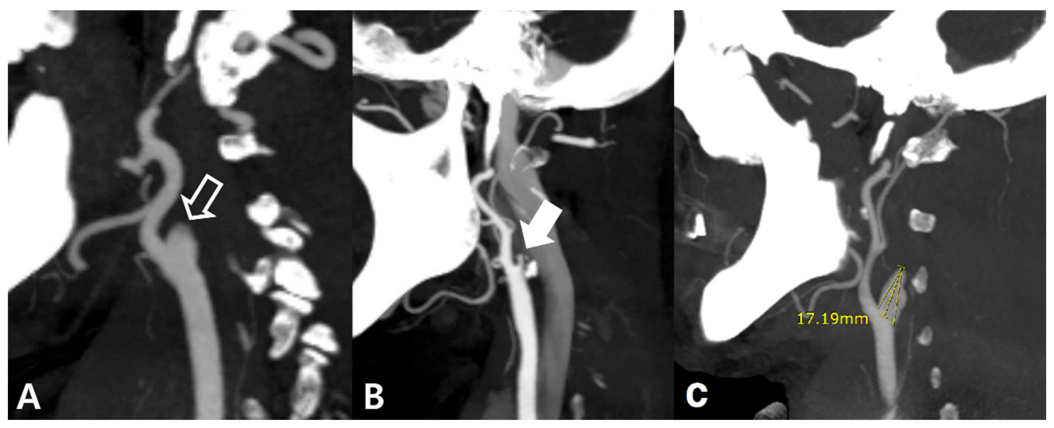 Diagnostics 12 00494 g001