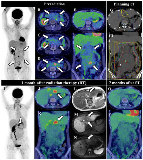 Diagnostics 12 00504 g001 550