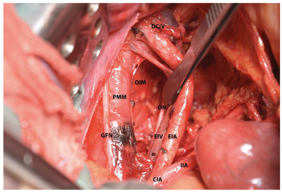 Diagnostics 12 00519 g012 550