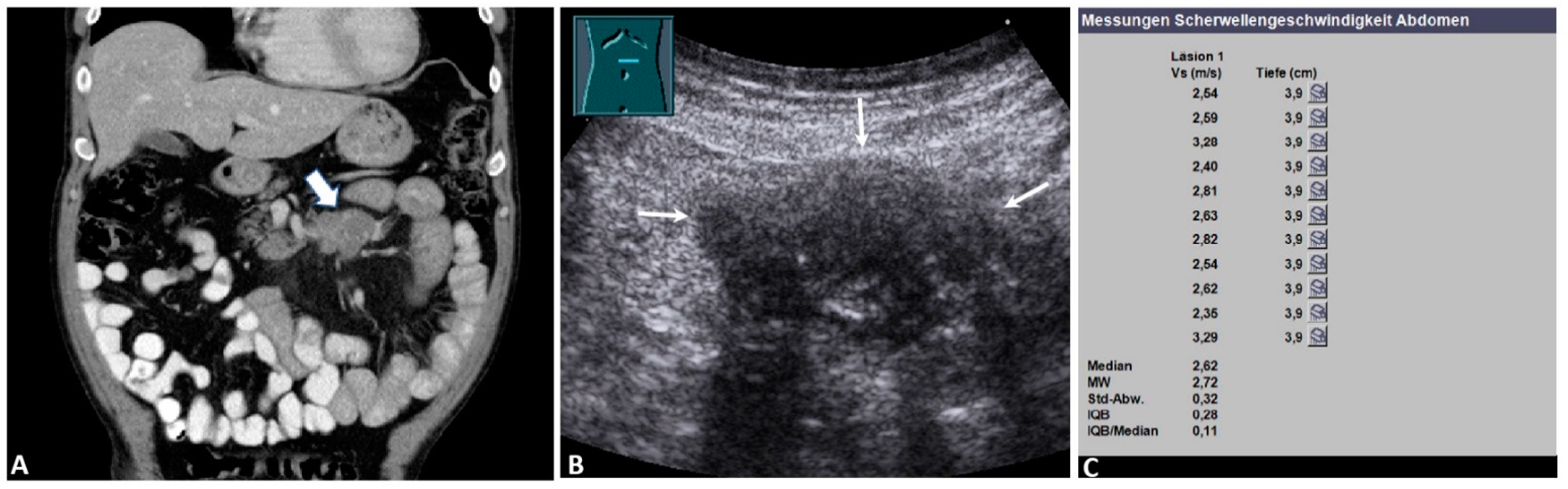 Diagnostics 12 00523 g002