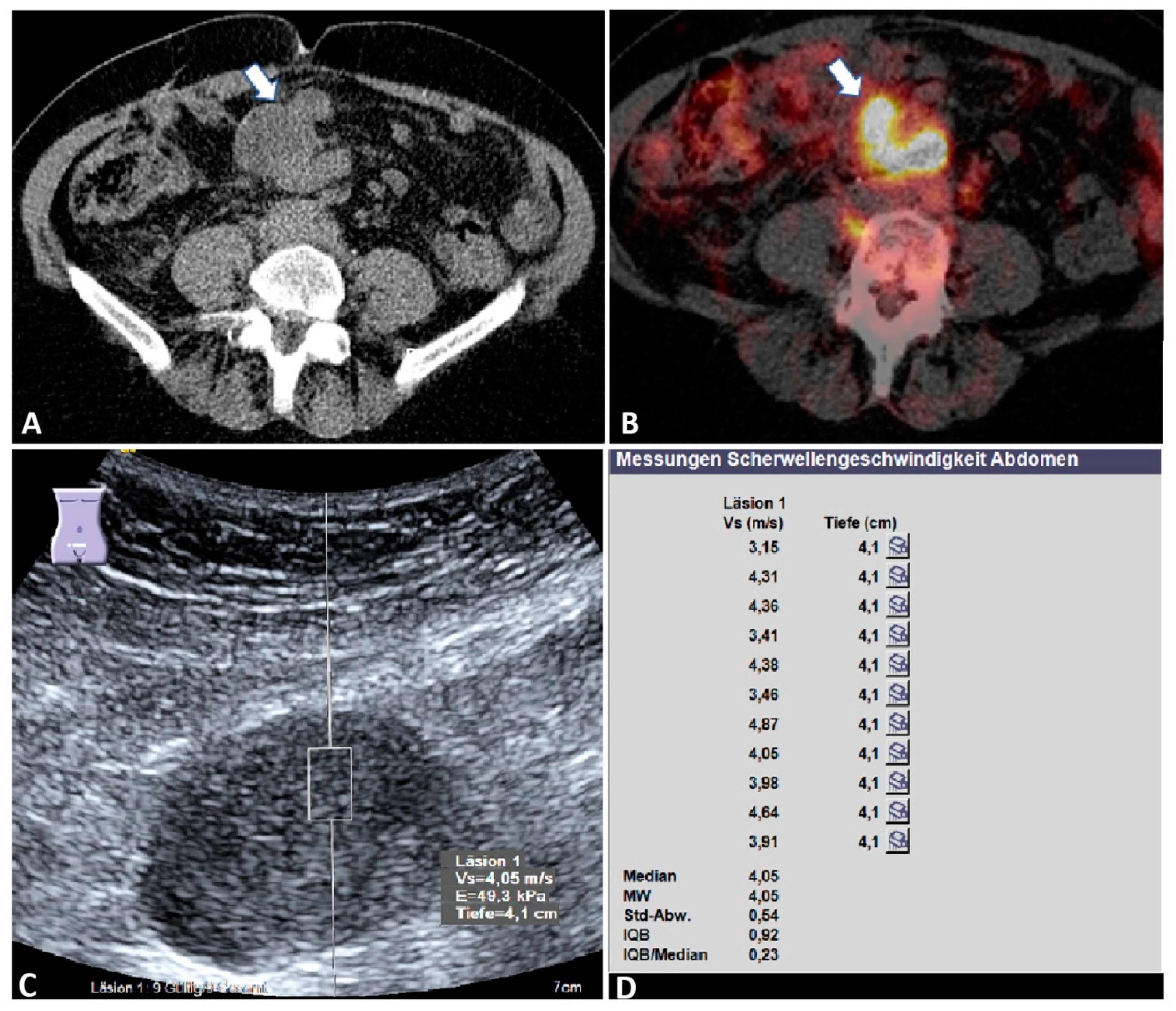 Diagnostics 12 00523 g003