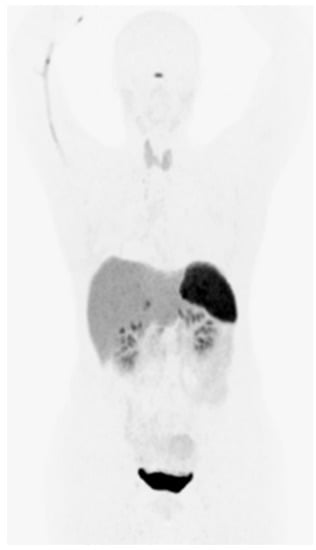 Diagnostics 12 00528 g001 Diagnostics 12 00528 g001