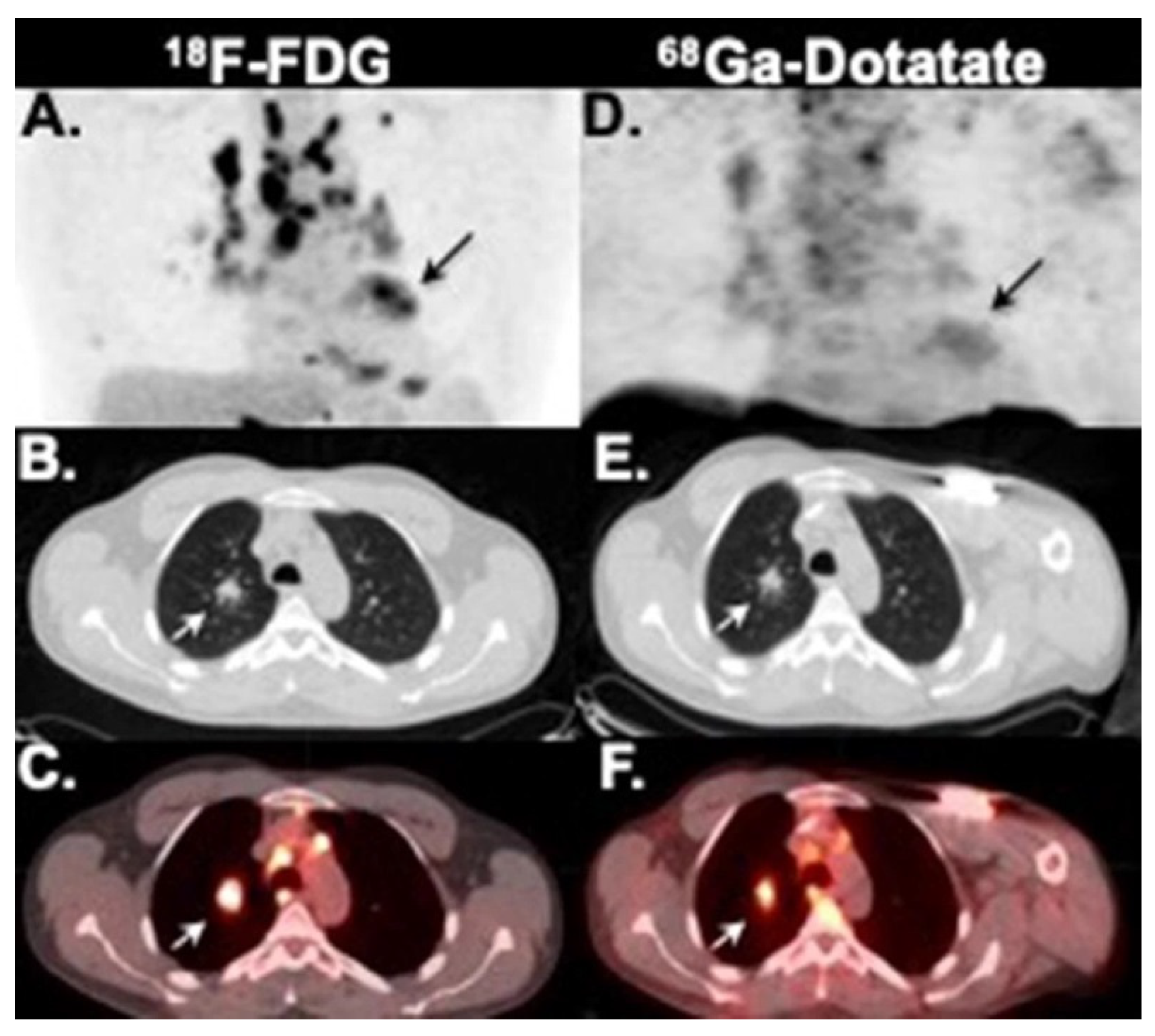 Diagnostics 12 00528 g004