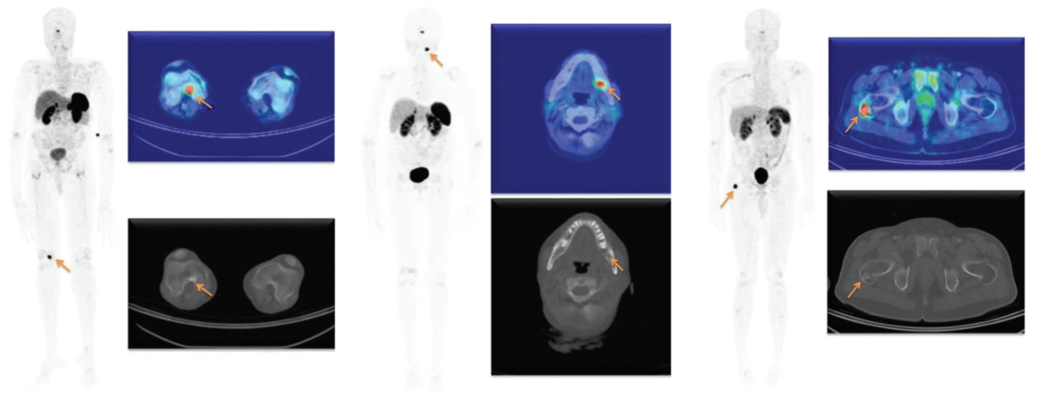 Diagnostics 12 00528 g005