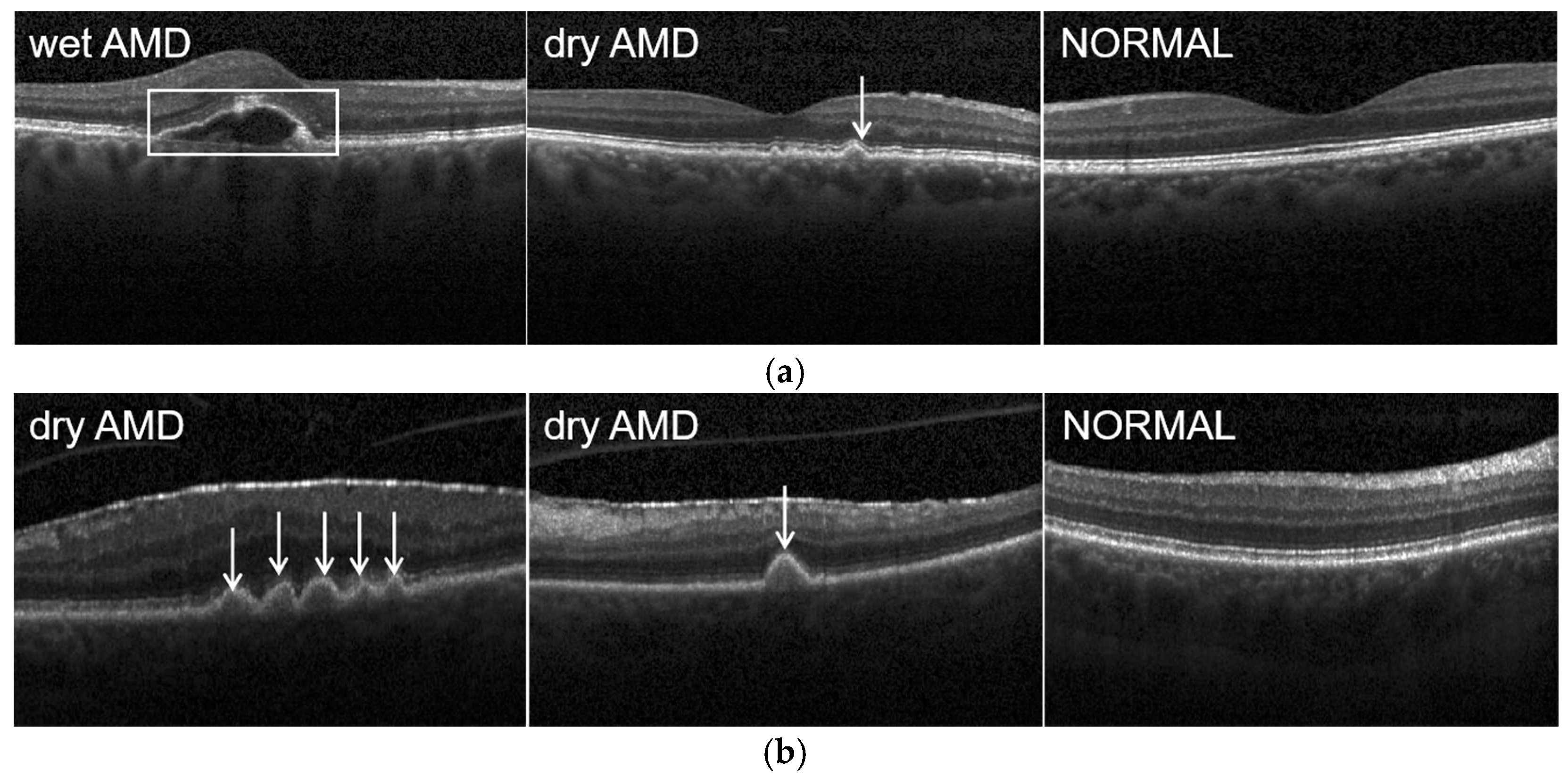 Diagnostics 12 00532 g005